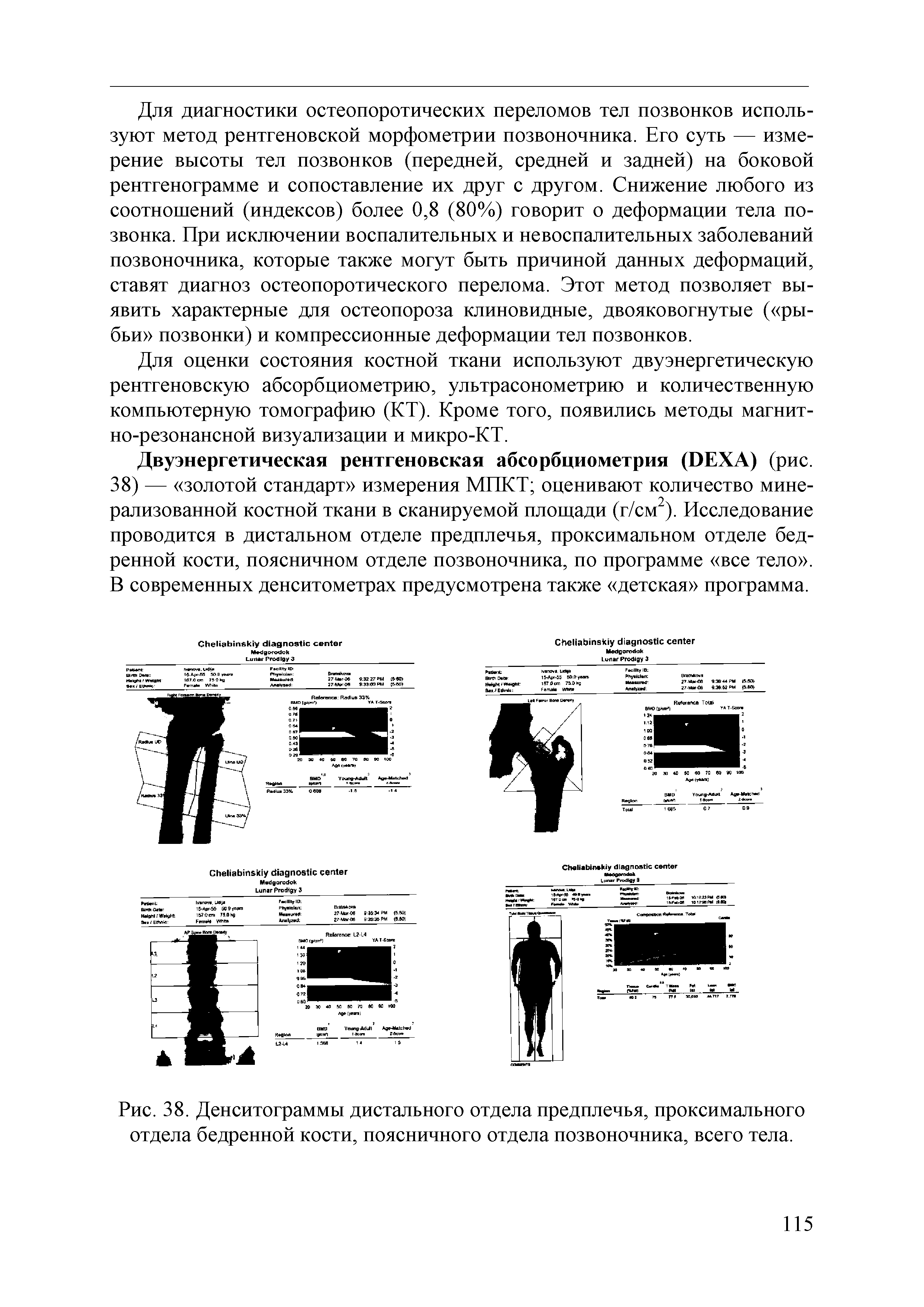 Рис. 38. Денситограммы дистального отдела предплечья, проксимального отдела бедренной кости, поясничного отдела позвоночника, всего тела.