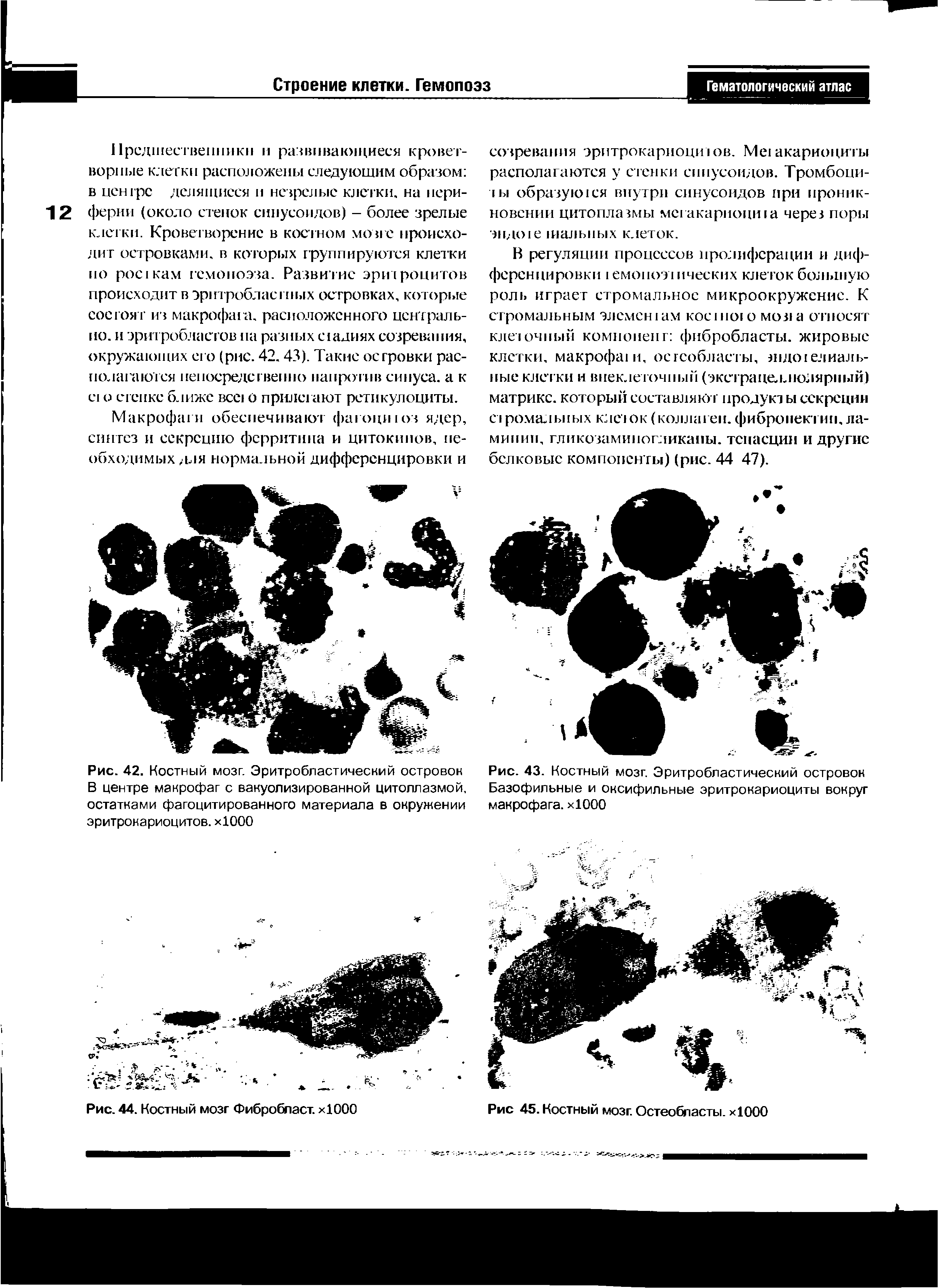 Рис. 42. Костный мозг. Эритробластический островок В центре макрофаг с вакуолизированной цитоплазмой, остатками фагоцитированного материала в окружении эритрокариоцитов. хЮОО...