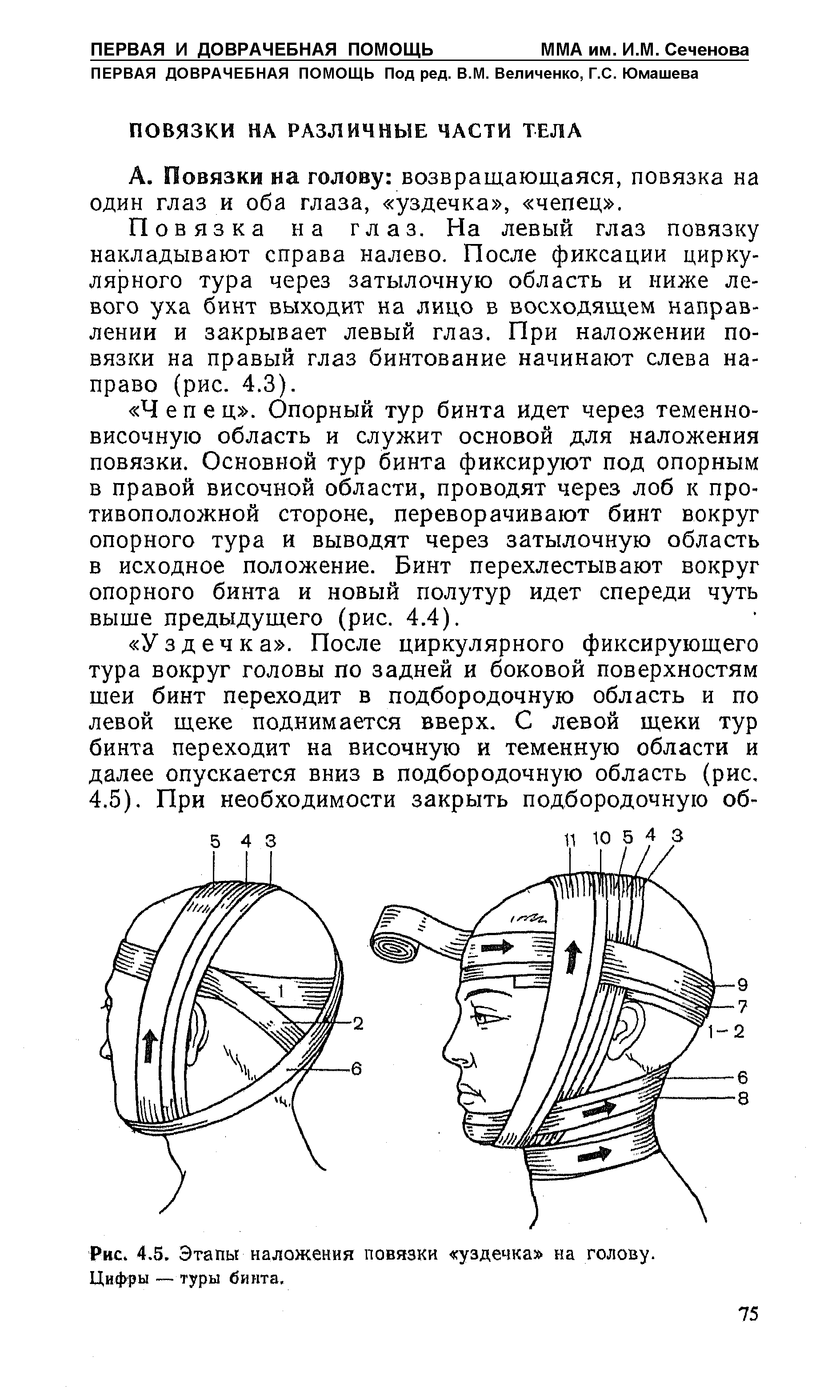 Рис. 4.5. Этапы наложения повязки уздечка на голову. Цифры — туры бинта.