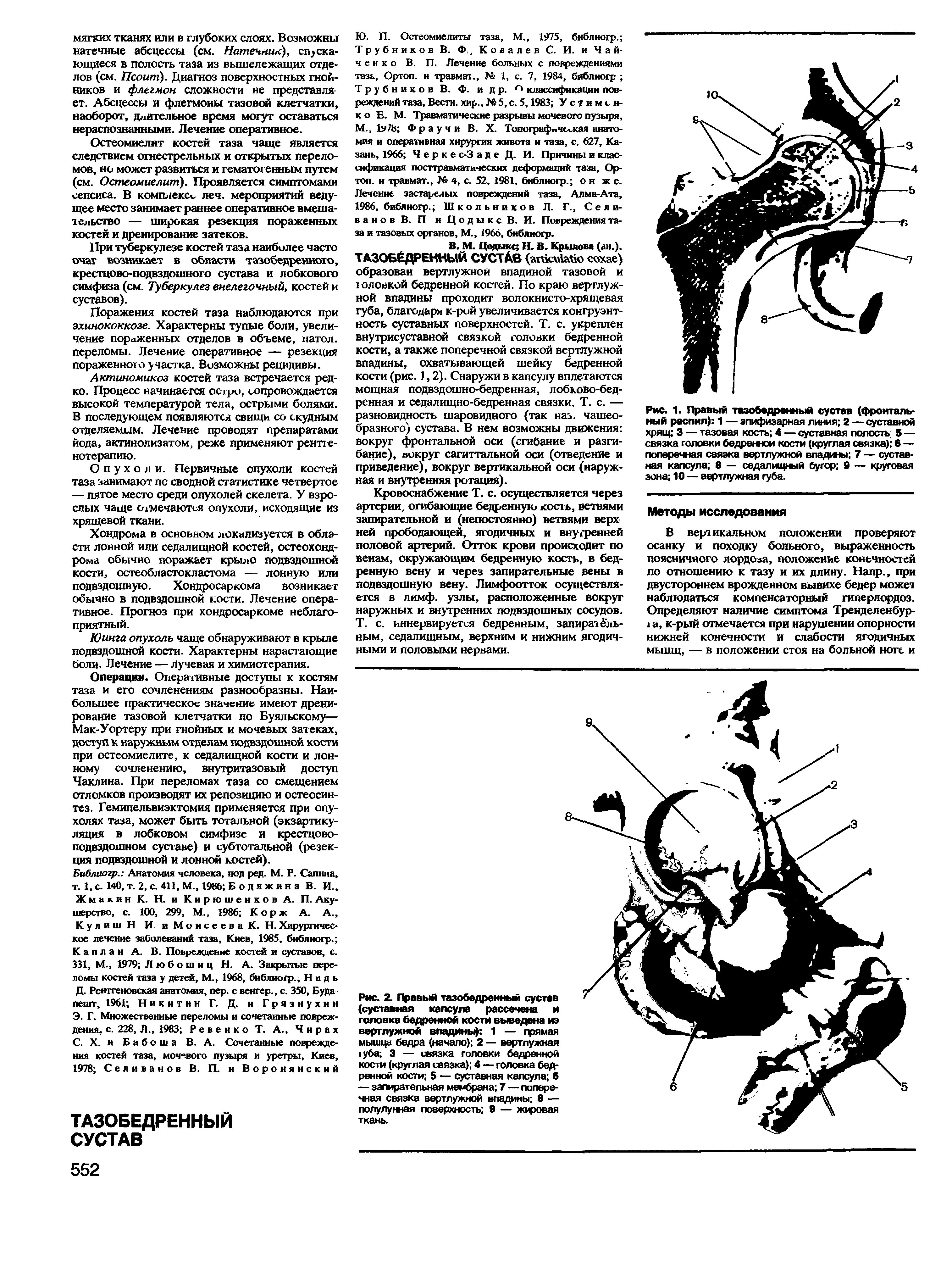 Рис. 1. Правый тазобедренный сустав (фронтальный распил) 1 — эпифизарная линия 2 — суставной хрящ 3 — тазовая кость 4 — суставная полость 5 — связка головки бедренной кости (круглая связка) в — поперечная связка вертлужной впадины 7 — суставная капсула б — седалищный бугор 9 — круговая зона 10 — аертлужная губа.