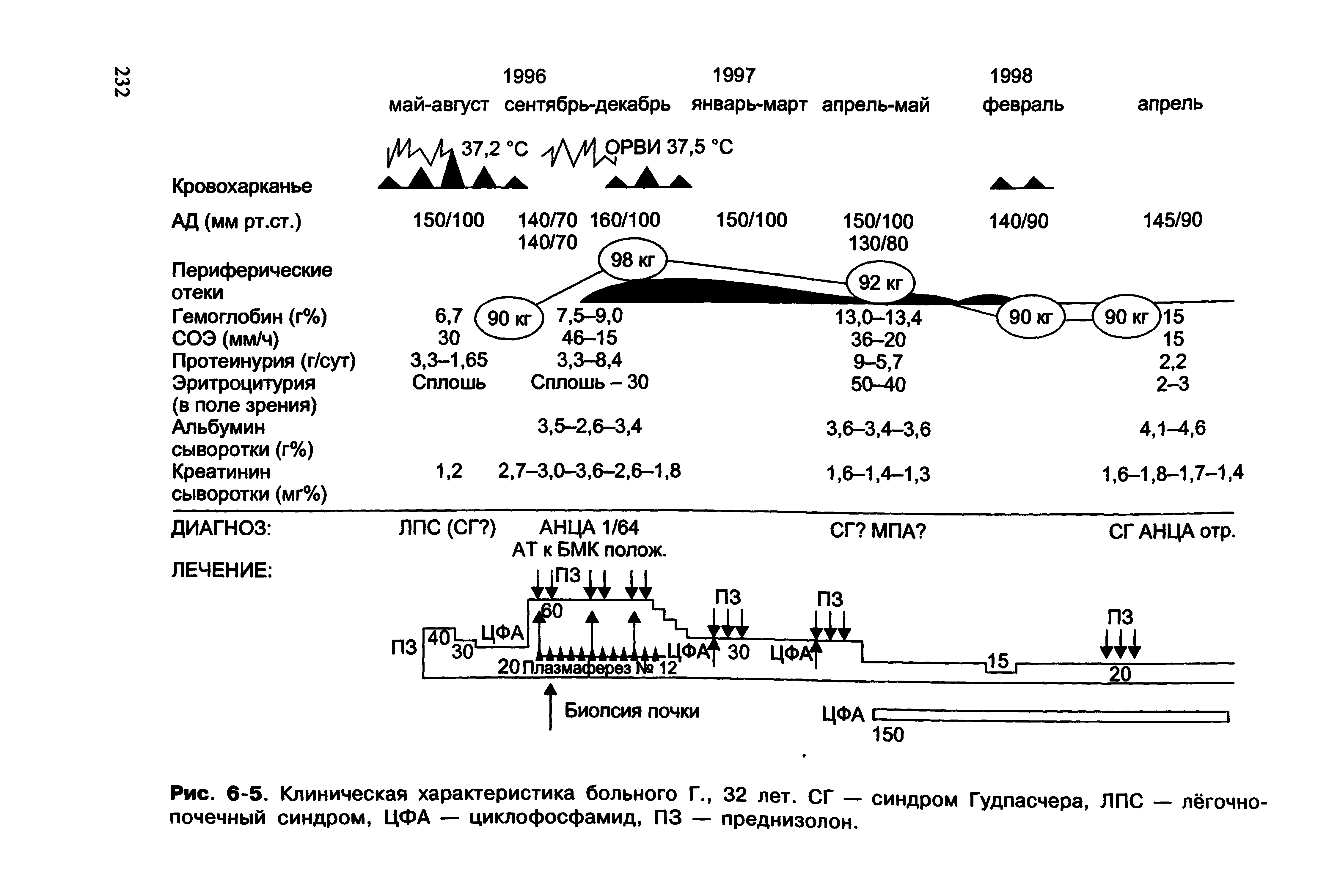 Рис. 6-5. Клиническая характеристика больного Г., 32 лет. СГ — синдром Гудпасчера, ЛПС — лё, почечный синдром, ЦФА — циклофосфамид, ПЗ — преднизолон.