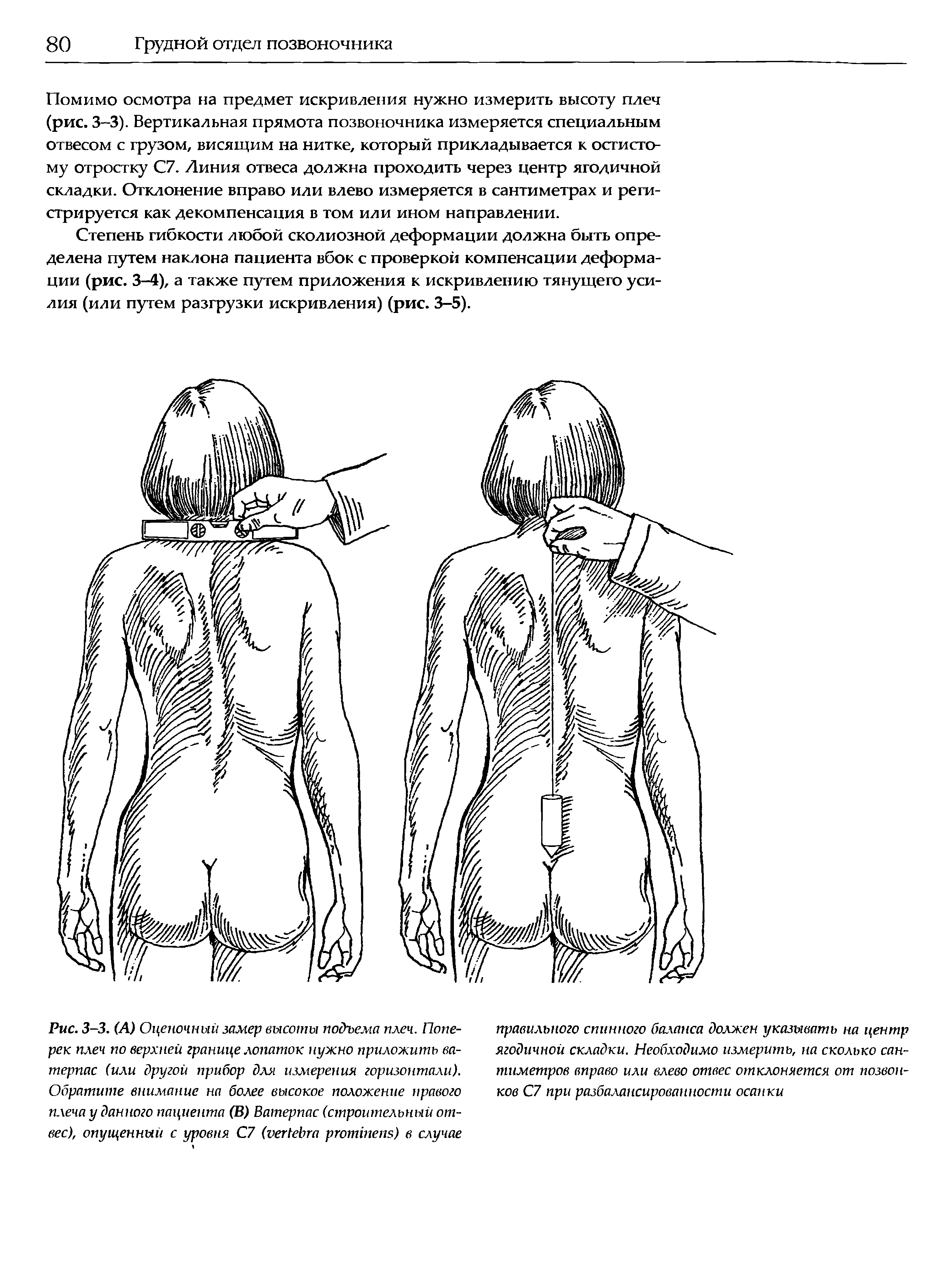 Рис. 3-3. (А) Оценочный замер высоты подъема плеч. Поперек плеч по верхней границе лопаток нужно приложить ватерпас (или другой прибор для измерения горизонтали). Обратите внимание на более высокое положение правого плеча у данного пациента (В) Ватерпас (строительный отвес), опущенный с уровня С7 ( ) в случае...