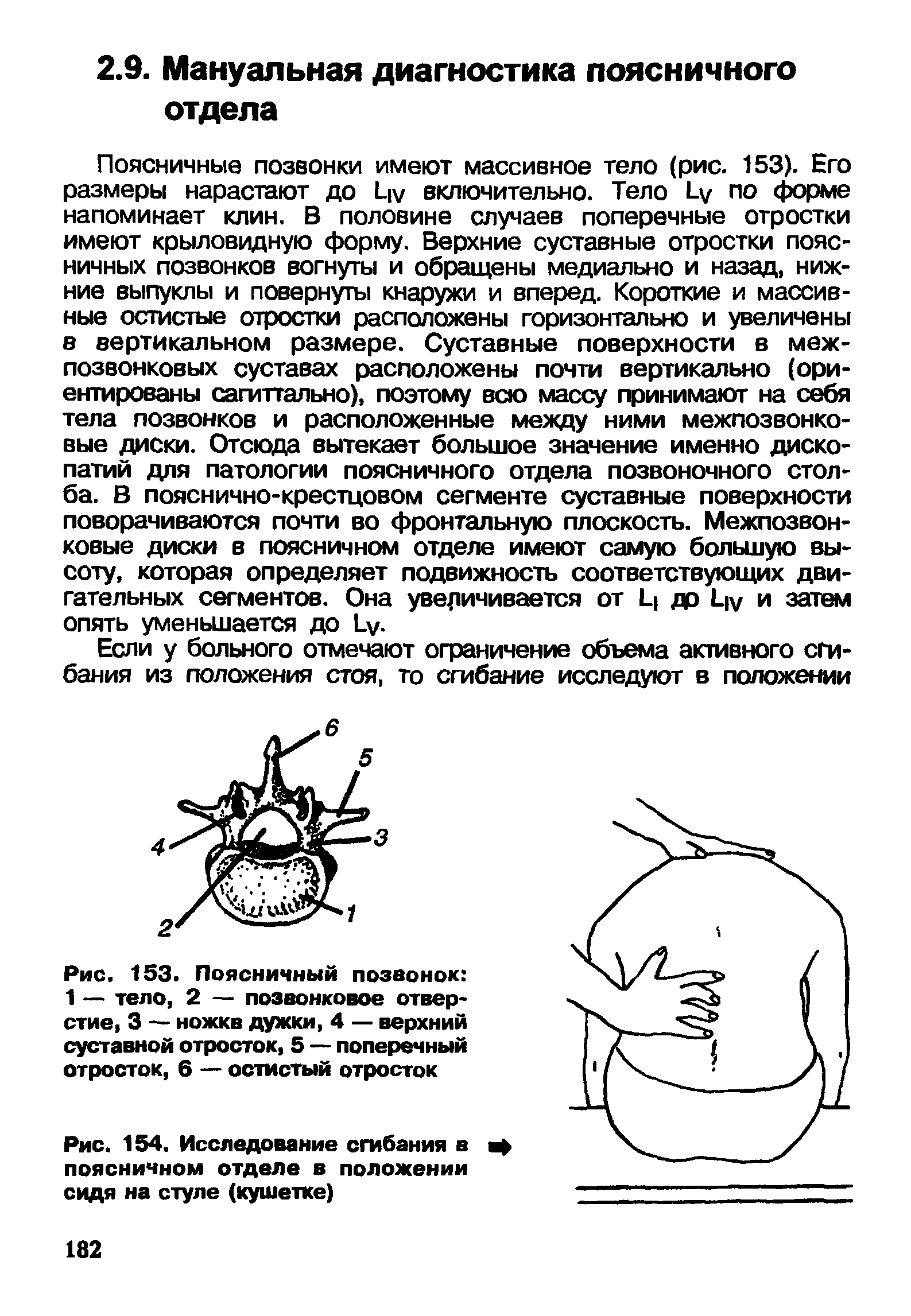 Рис. 153. Поясничный позвонок 1 — тело, 2 — позвонковое отверстие, 3 — ножкв дужки, 4 — верхний суставной отросток, 5 — поперечный отросток, 6 — остистый отросток...