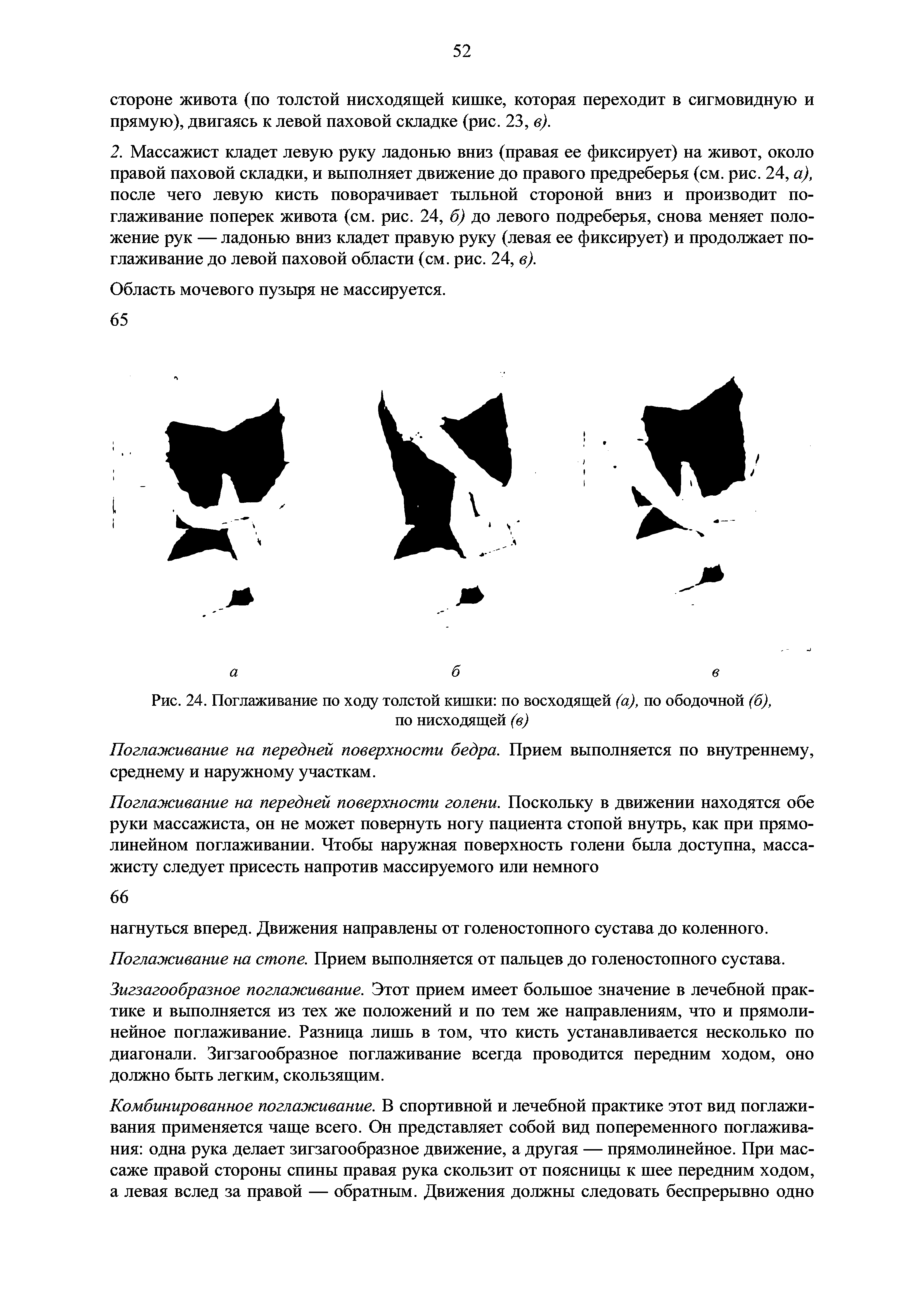 Рис. 24. Поглаживание по ходу толстой кишки по восходящей (а), по ободочной (б), по нисходящей (в)...