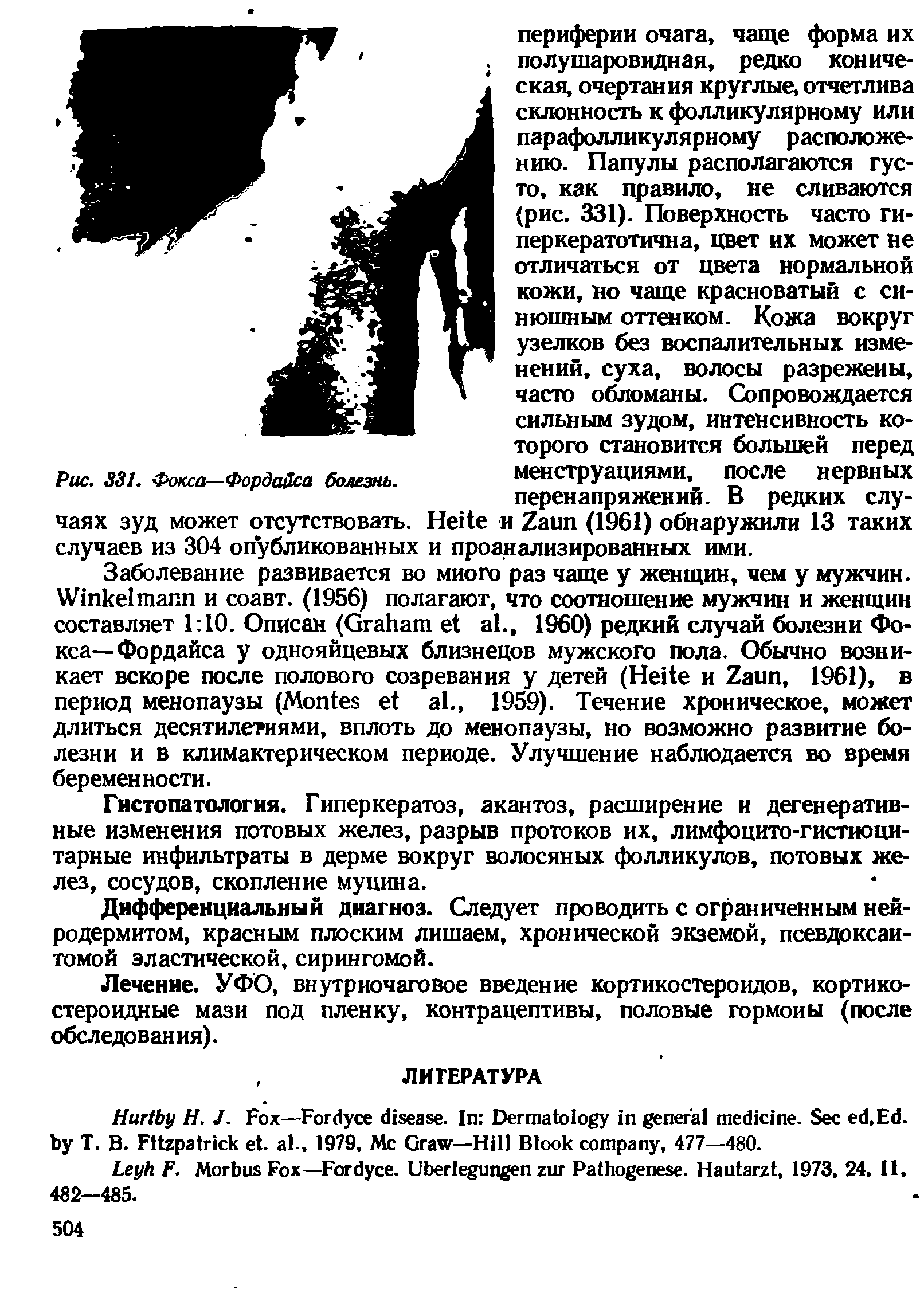 Рис. 331. Фокса—Фордайса болезнь. менструациями, после нервных...