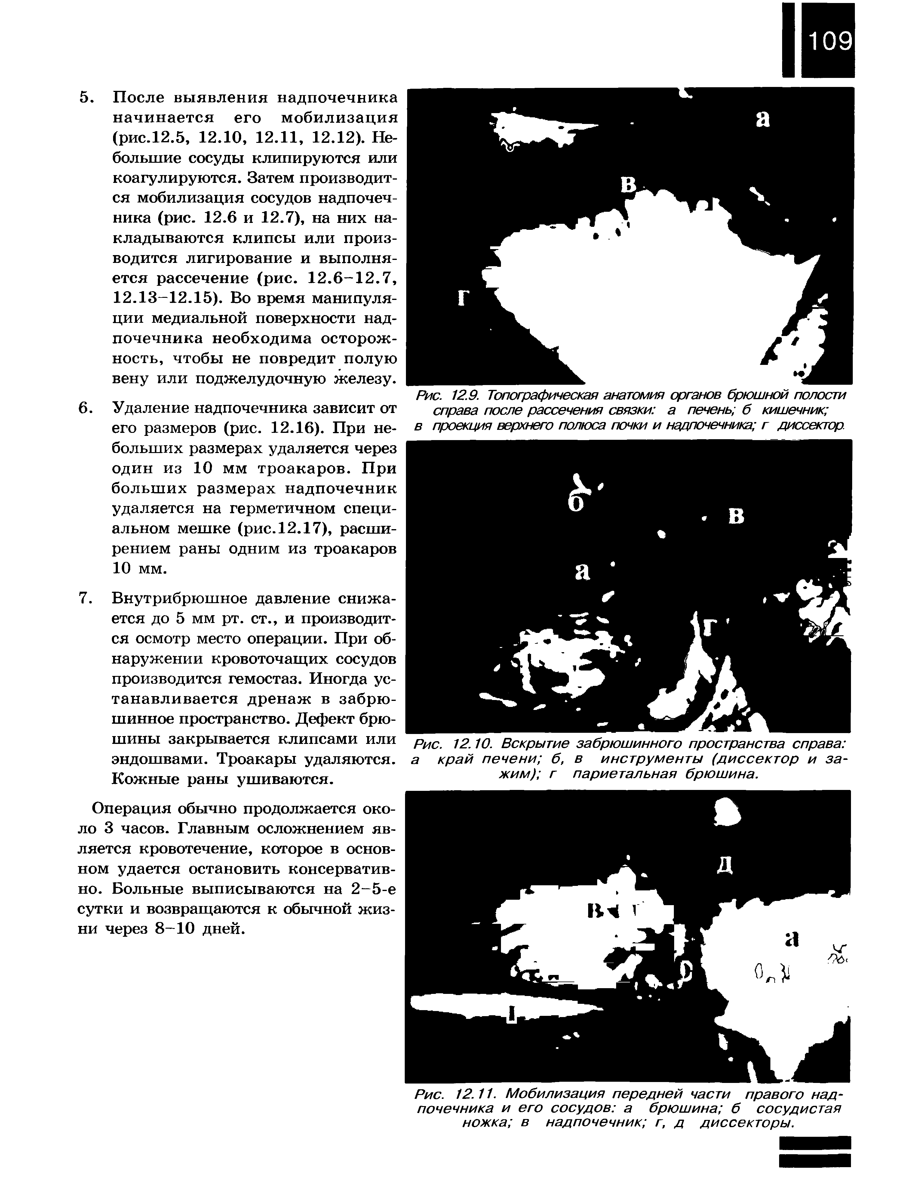 Рис. 12.9. Топографическая анатомия органов брюшной полости справа после рассечения связки а печень б кишечник ...