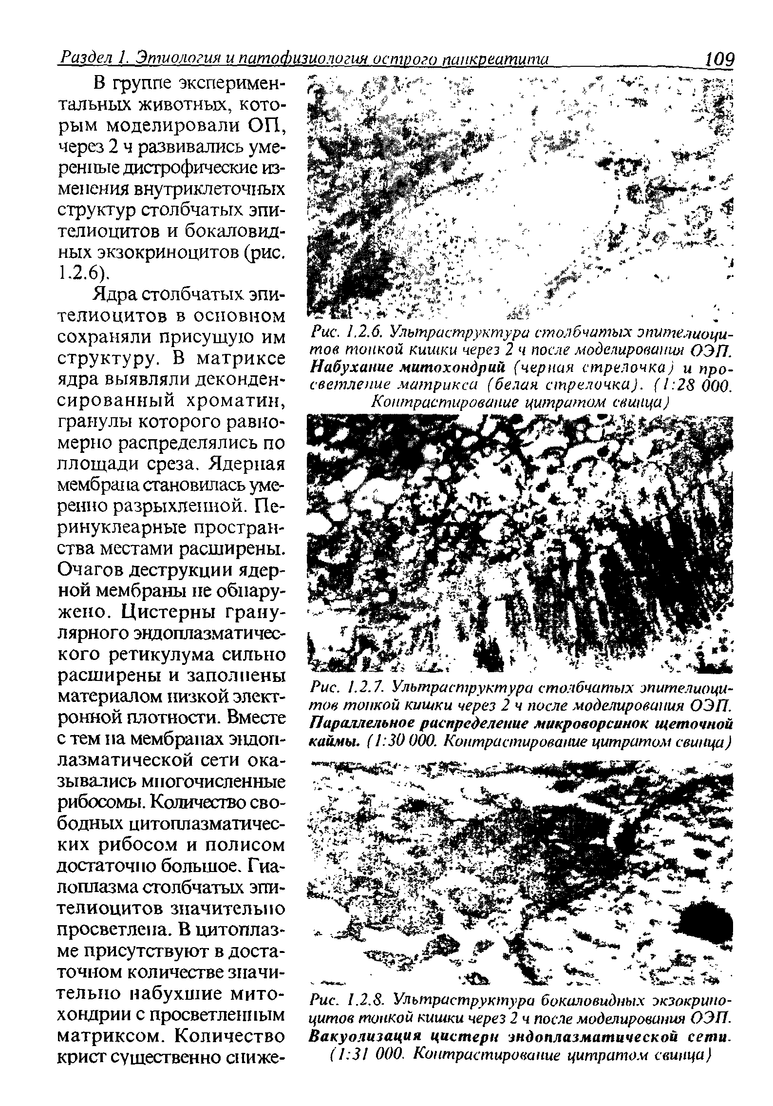 Рис. 1.2.7. Ультраструктура столбчатых эпителиоцитов тонкой кишки через 2 ч после моделирования ОЭП. Параллельное распределение микроворсинок щеточной каймы. (1 30 000. Контрастирование цитратом свинца)...