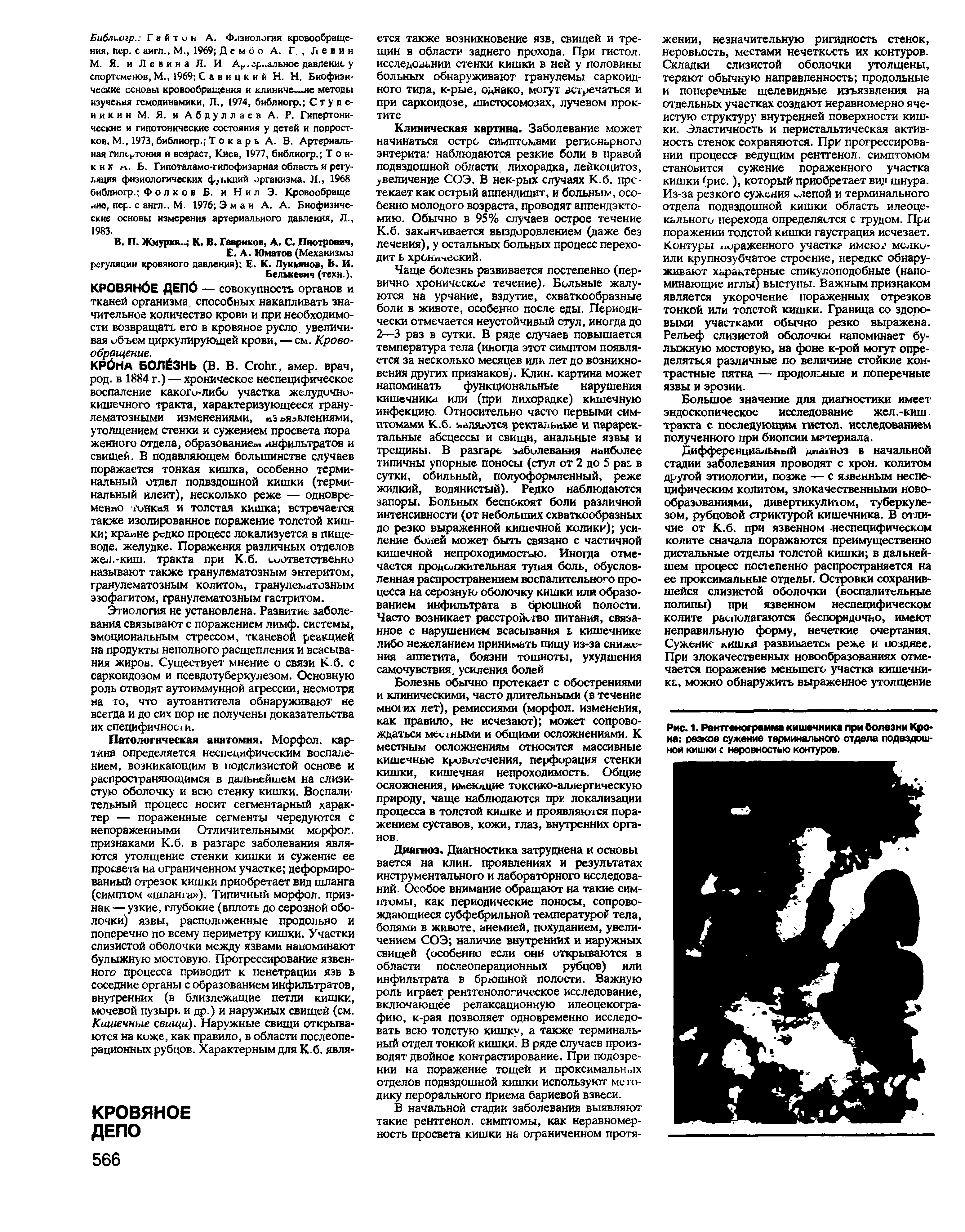 Рис. 1. Рентгенограмма кишечника при болезни Крона резкое сужение терминального отдела подвздошной кишки с неровностью контуров.