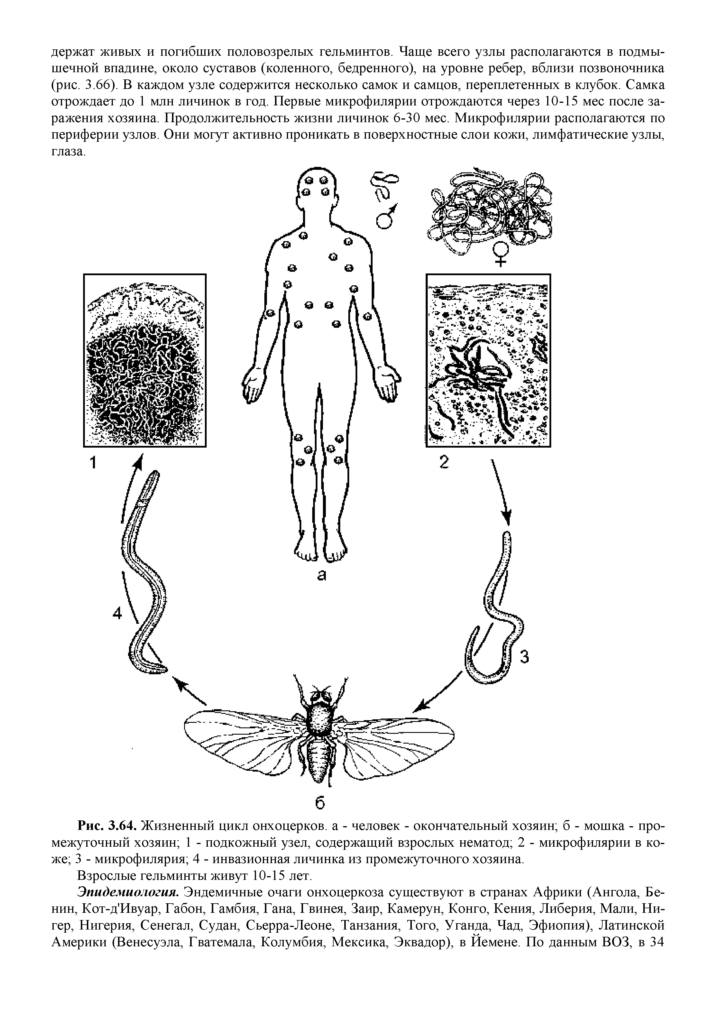 Рис. 3.64. Жизненный цикл онхоцерков. а - человек - окончательный хозяин б - мошка - промежуточный хозяин 1 - подкожный узел, содержащий взрослых нематод 2 - микрофилярии в коже 3 - микрофилярия 4 - инвазионная личинка из промежуточного хозяина.
