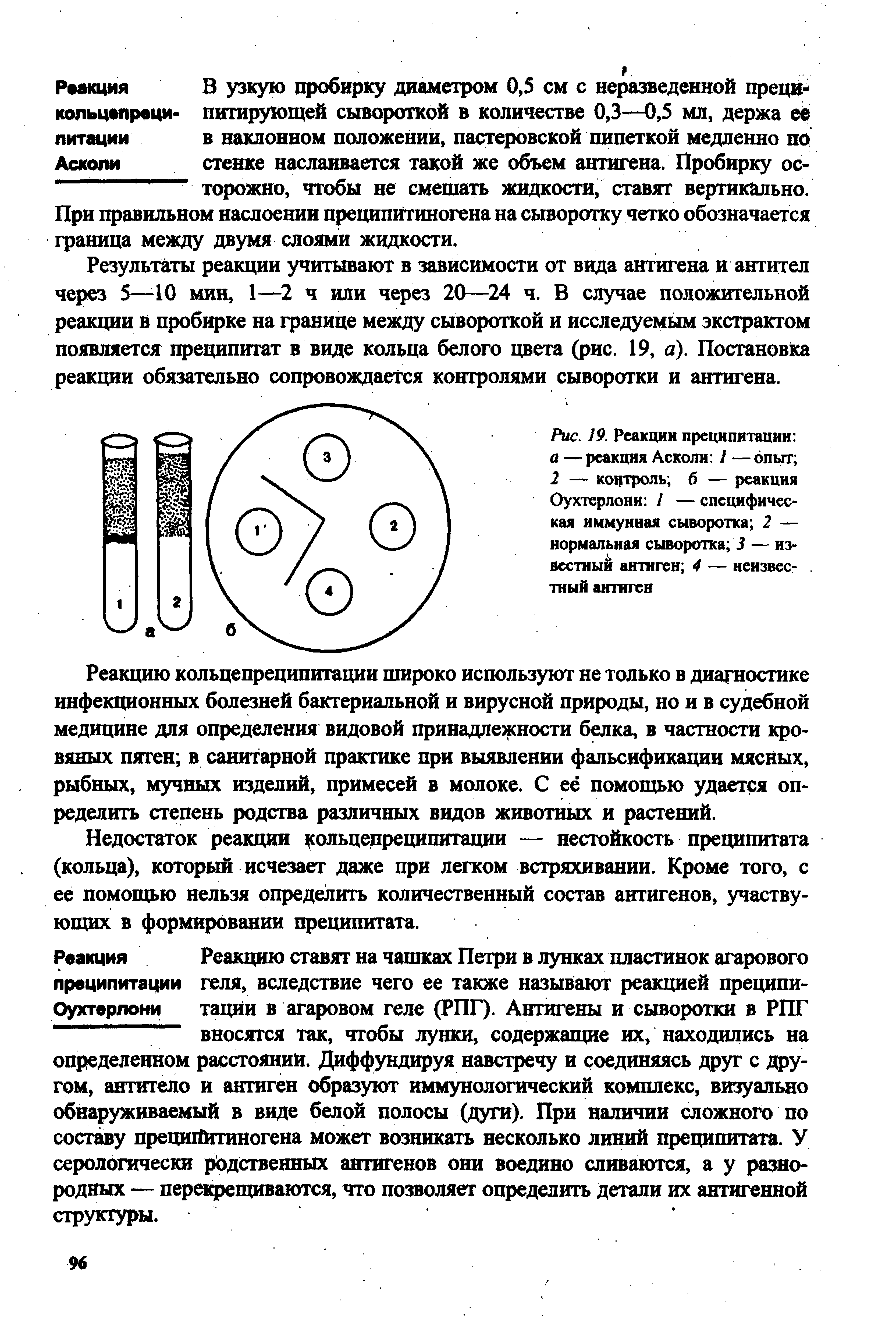 Рис. 19. Реакции преципитации а — реакция Асколи / — опыт 2 — контроль б — реакция Оухтерлони / — специфическая иммунная сыворотка 2 — нормальная сыворотка 3 — известный антиген 4 — неизвес-. тный антиген...