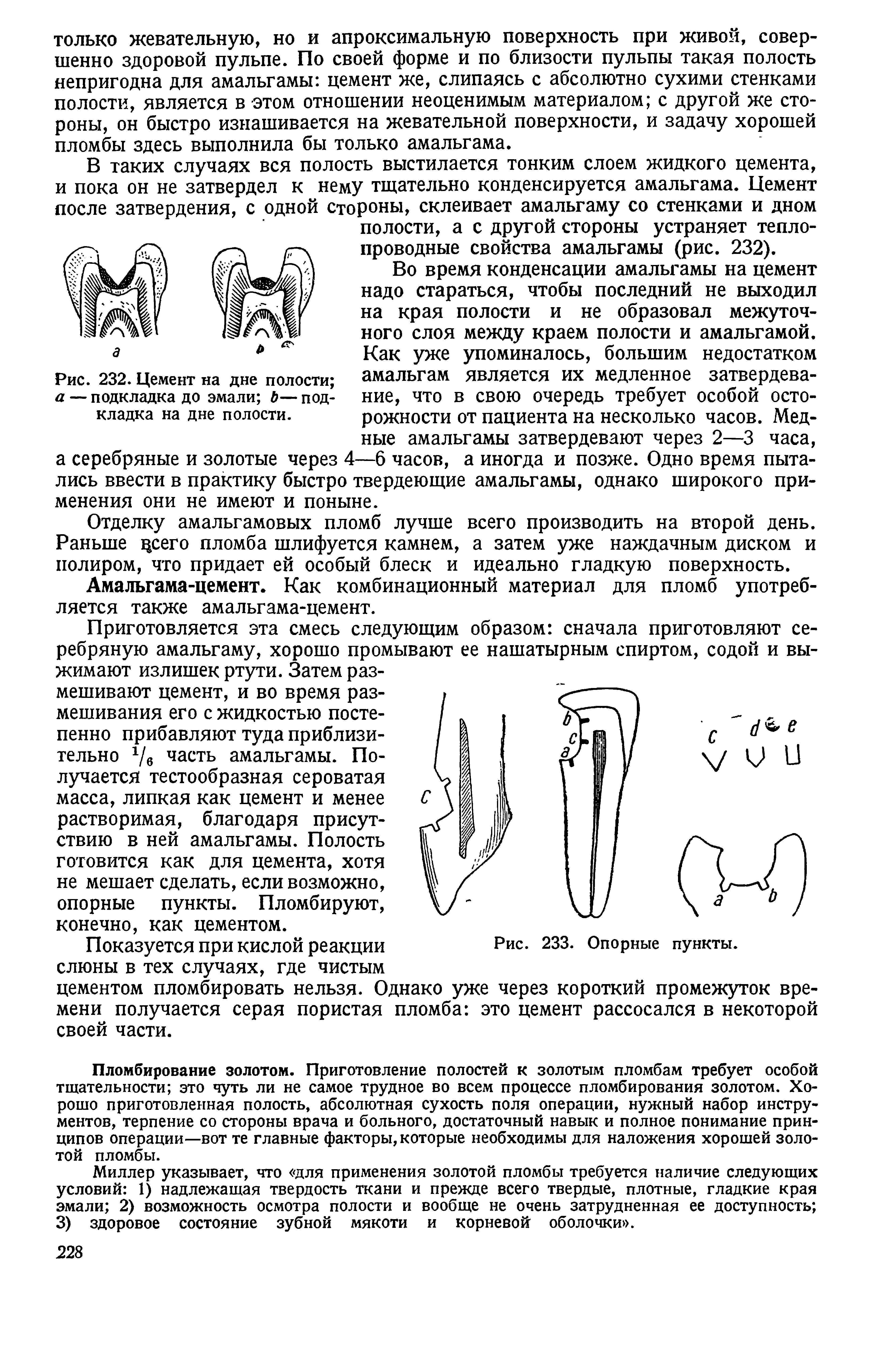 Рис. 232. Цемент на дне полости а — подкладка до эмали Ь— подкладка на дне полости.