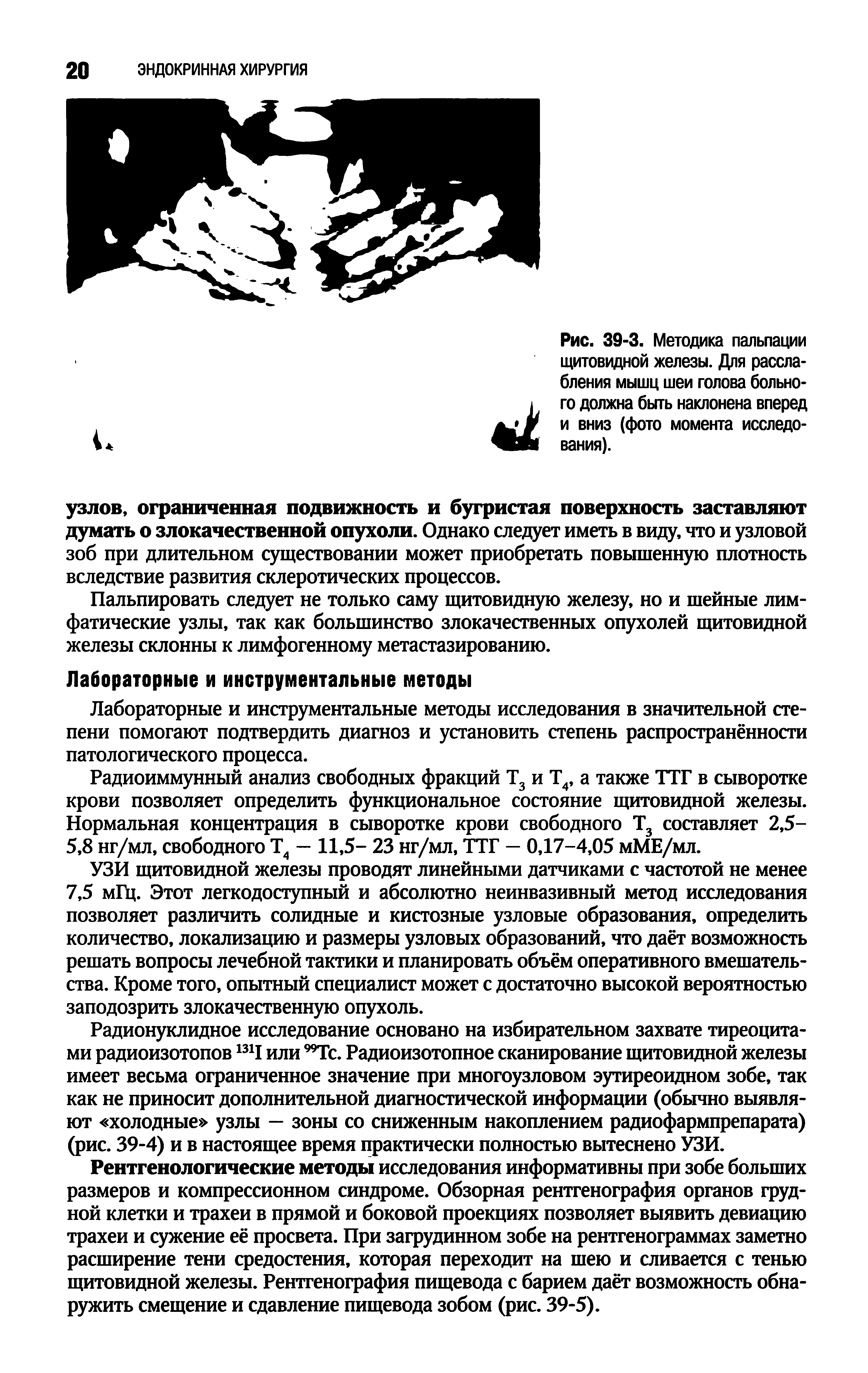 Рис. 39-3. Методика пальпации щитовидной железы. Для расслабления мышц шеи голова больного должна быть наклонена вперед и вниз (фото момента исследования).