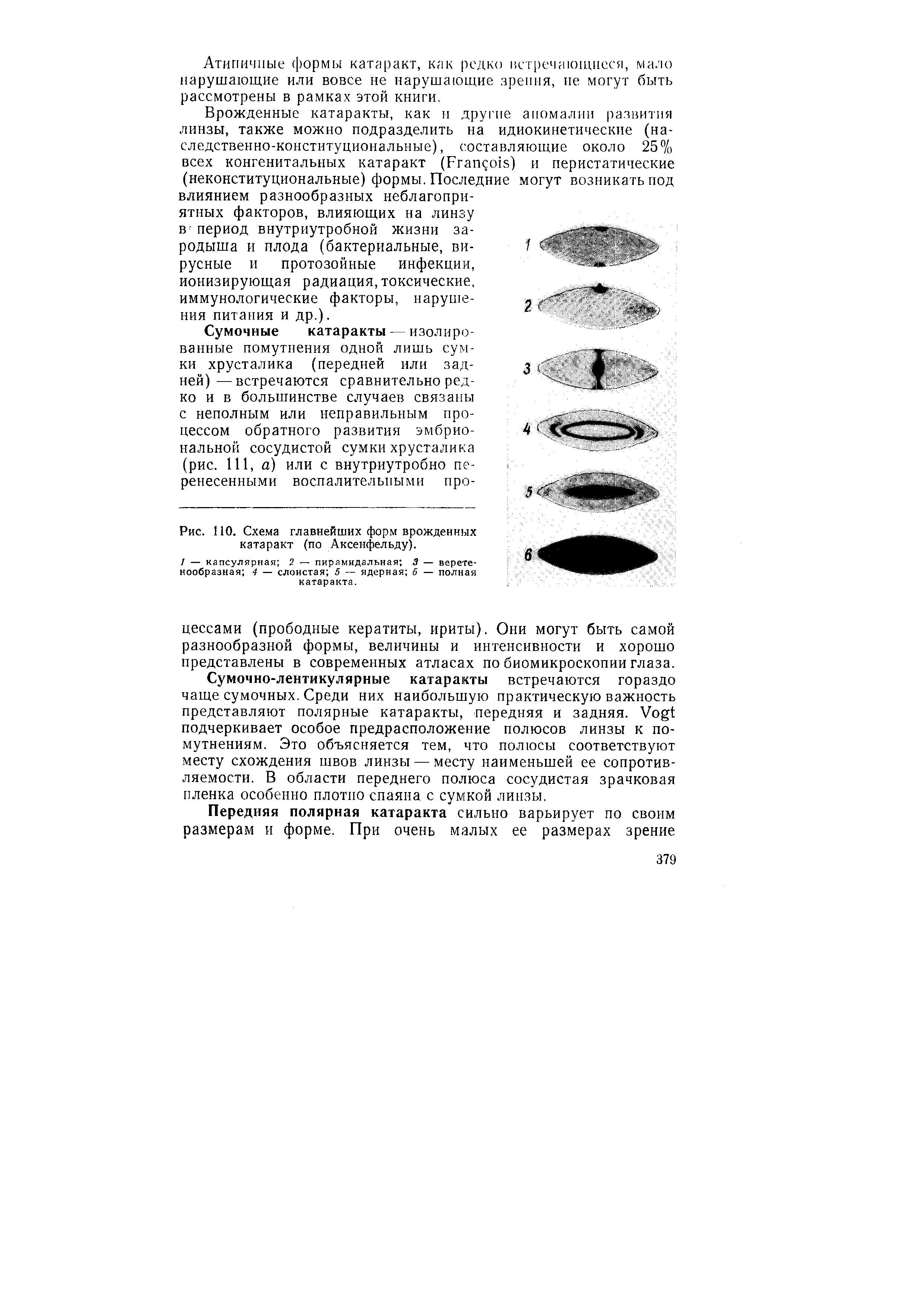 Рис. НО. Схема главнейших форм врожденных катаракт (по Аксенфельду).