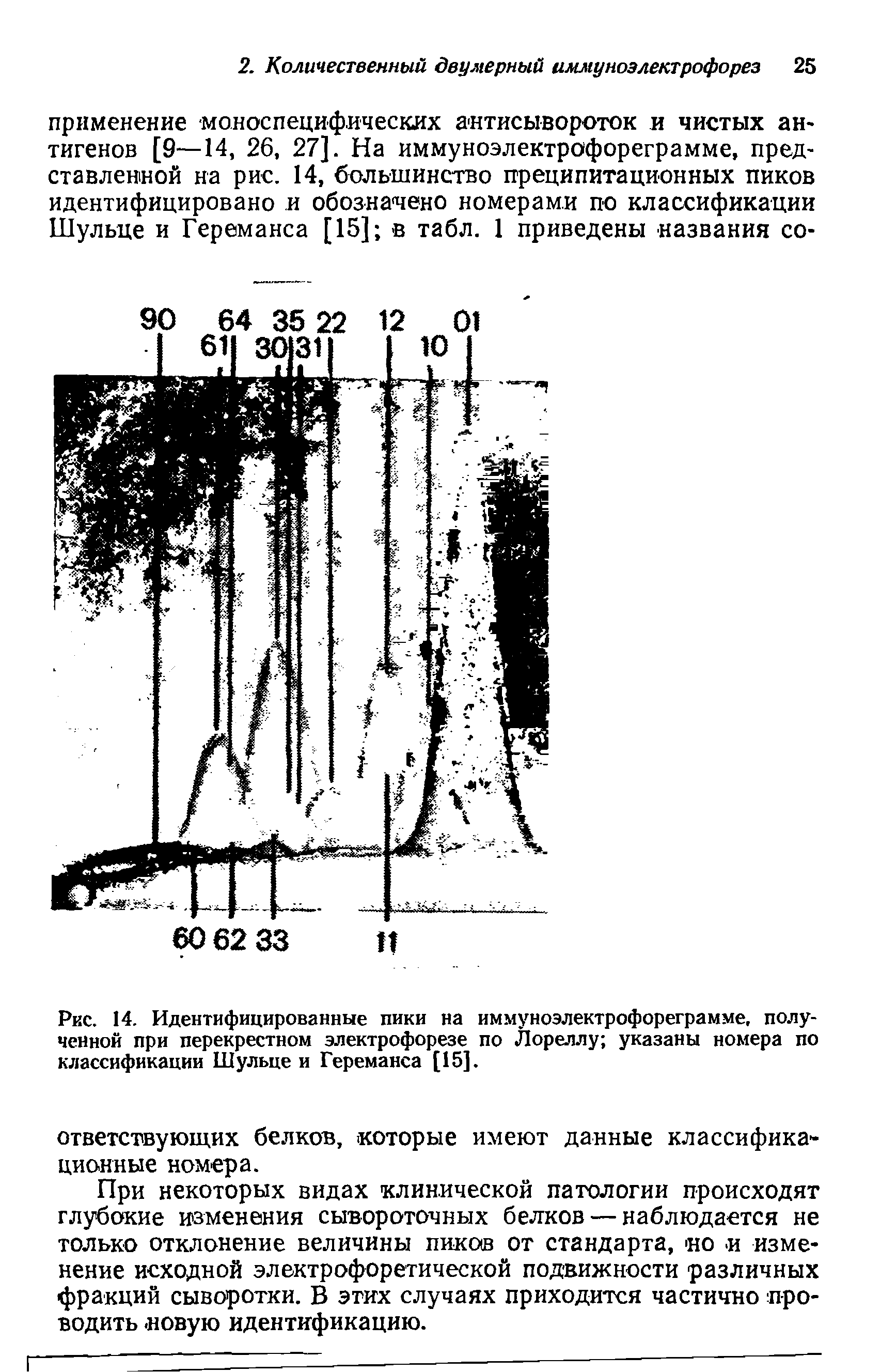 Рис. 14. Идентифицированные пики на иммуноэлектрофореграмме, полученной при перекрестном электрофорезе по Лореллу указаны номера по классификации Шульце и Гереманса [15].