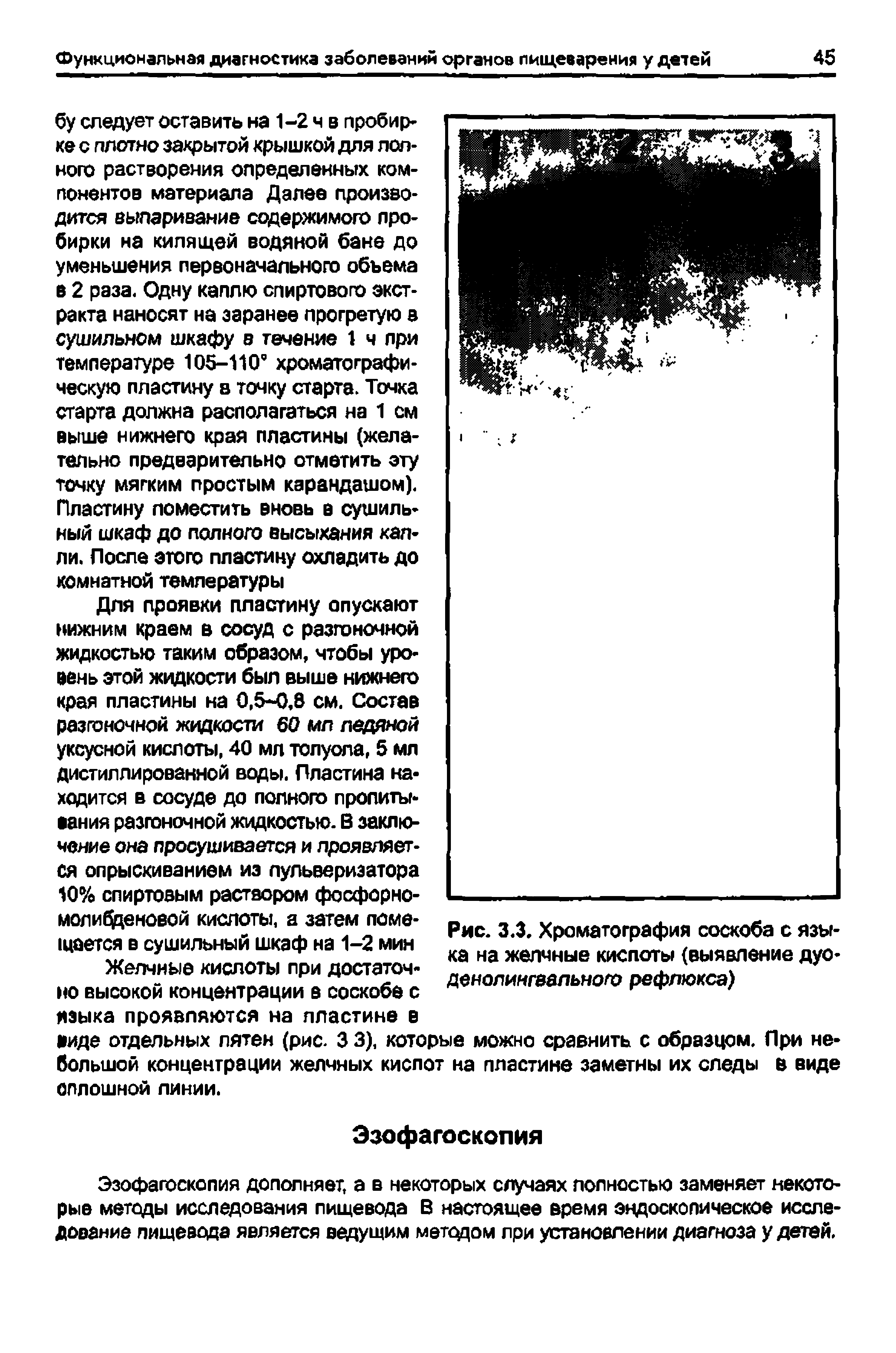 Рис. 3.3. Хроматография соскоба с языка на желчные кислоты (выявление дуо-денолингвального рефлюкса)...