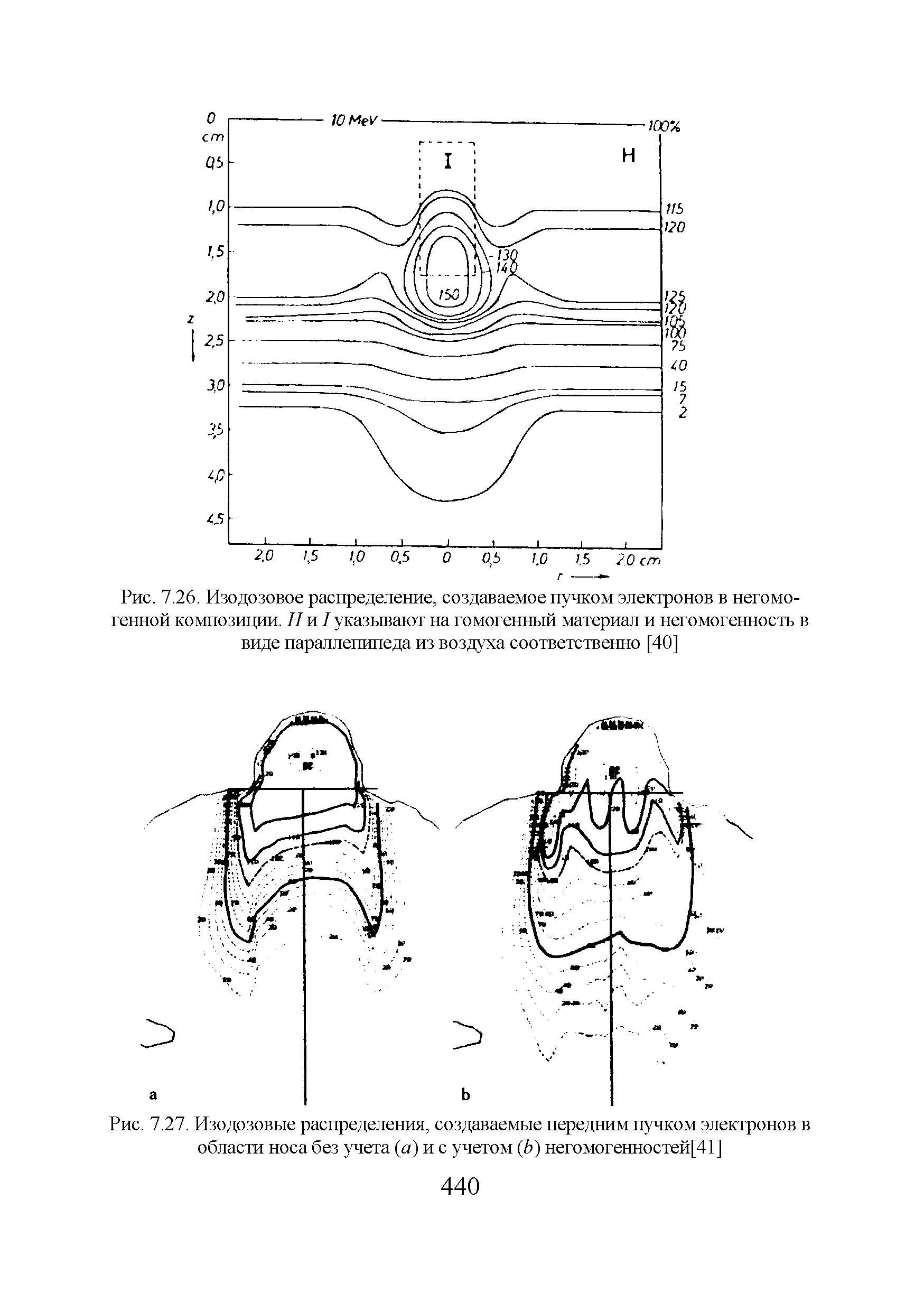 Рис. 7.27. Изодозовые распределения, создаваемые передним пучком электронов в области носа без учета (а) и с учетом (Ь) негомогенностей[41]...