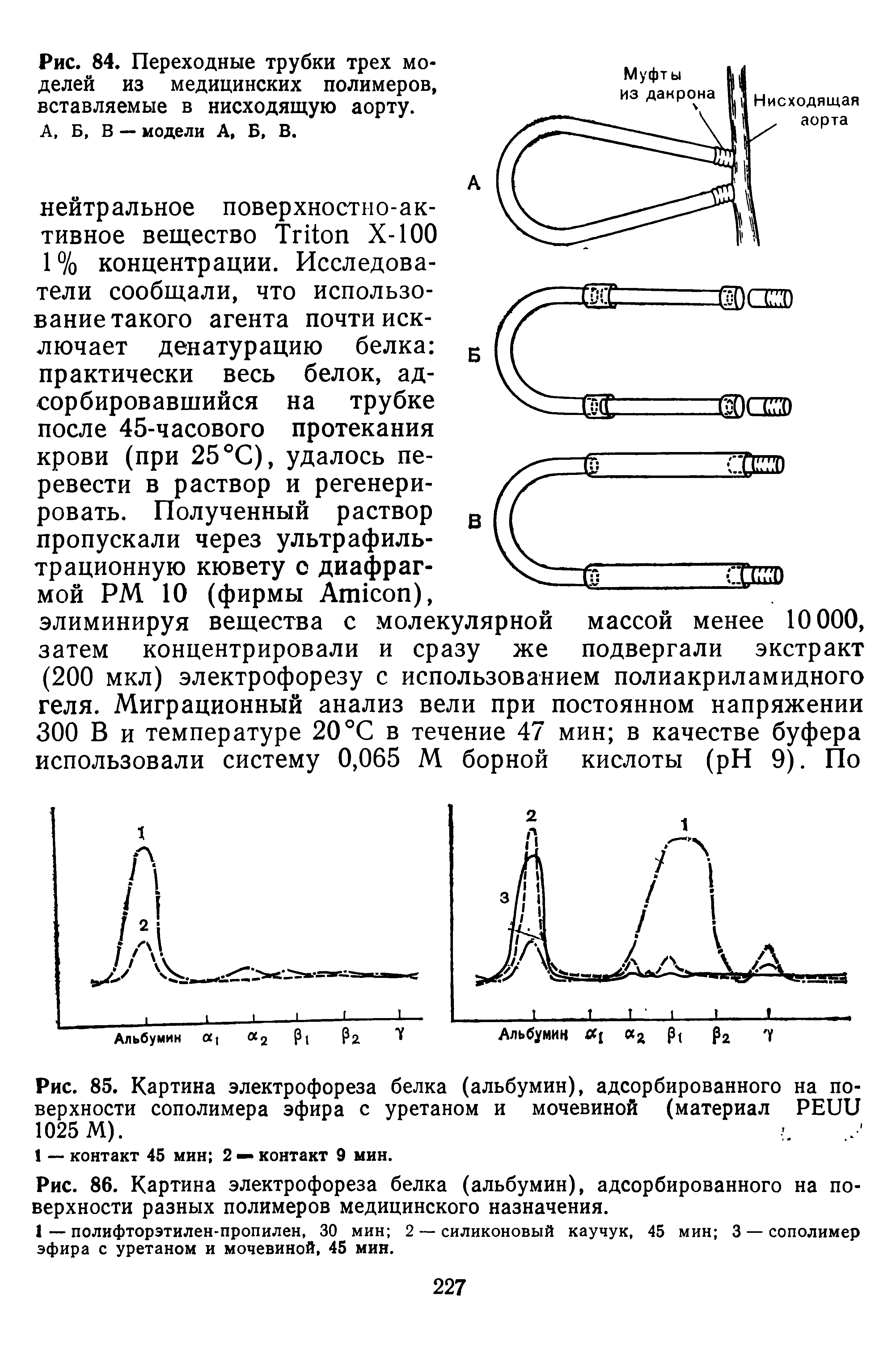 Рис. 86. Картина электрофореза белка (альбумин), адсорбированного на поверхности разных полимеров медицинского назначения.