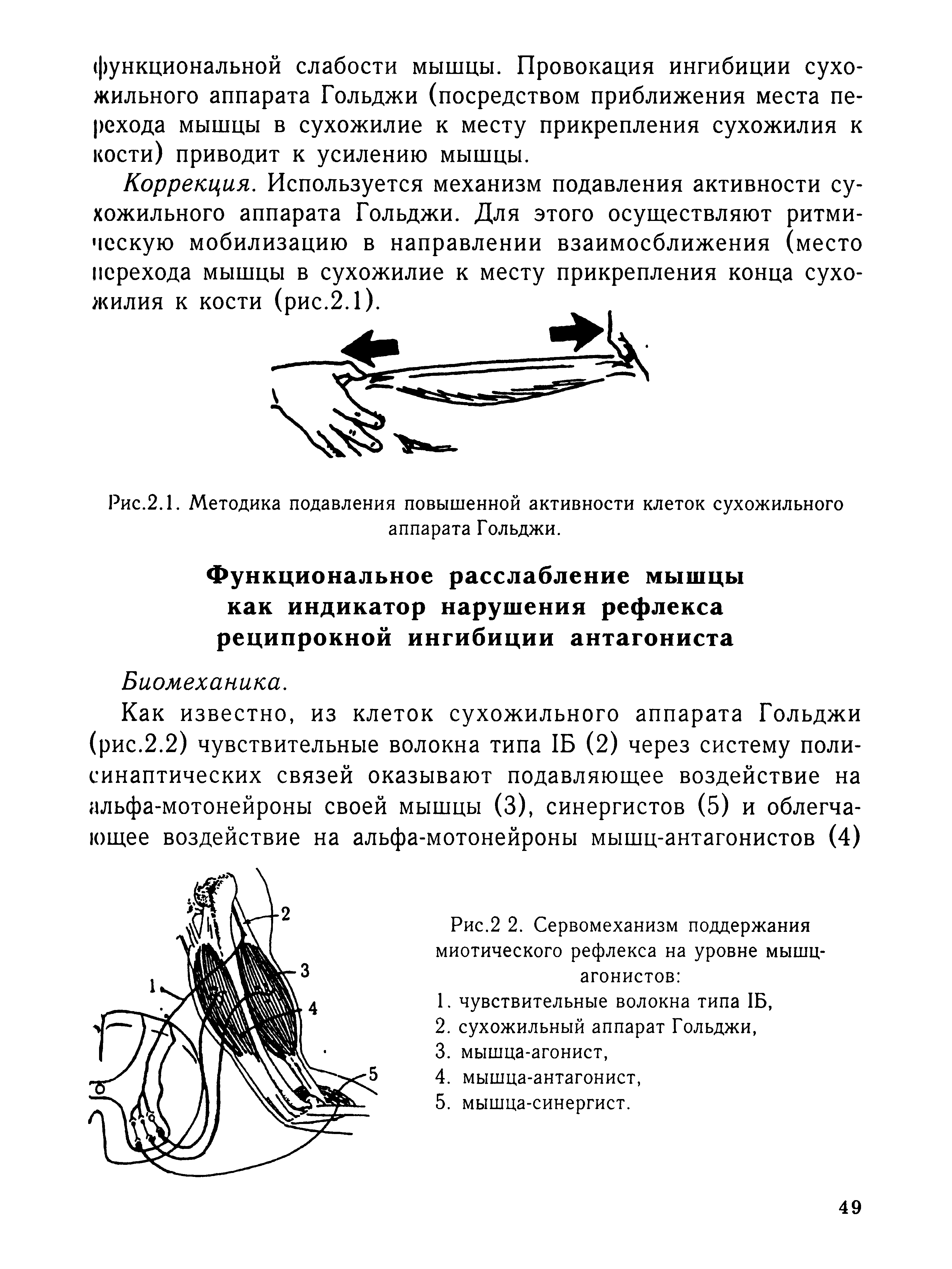 Рис.2.1. Методика подавления повышенной активности клеток сухожильного аппарата Гольджи.