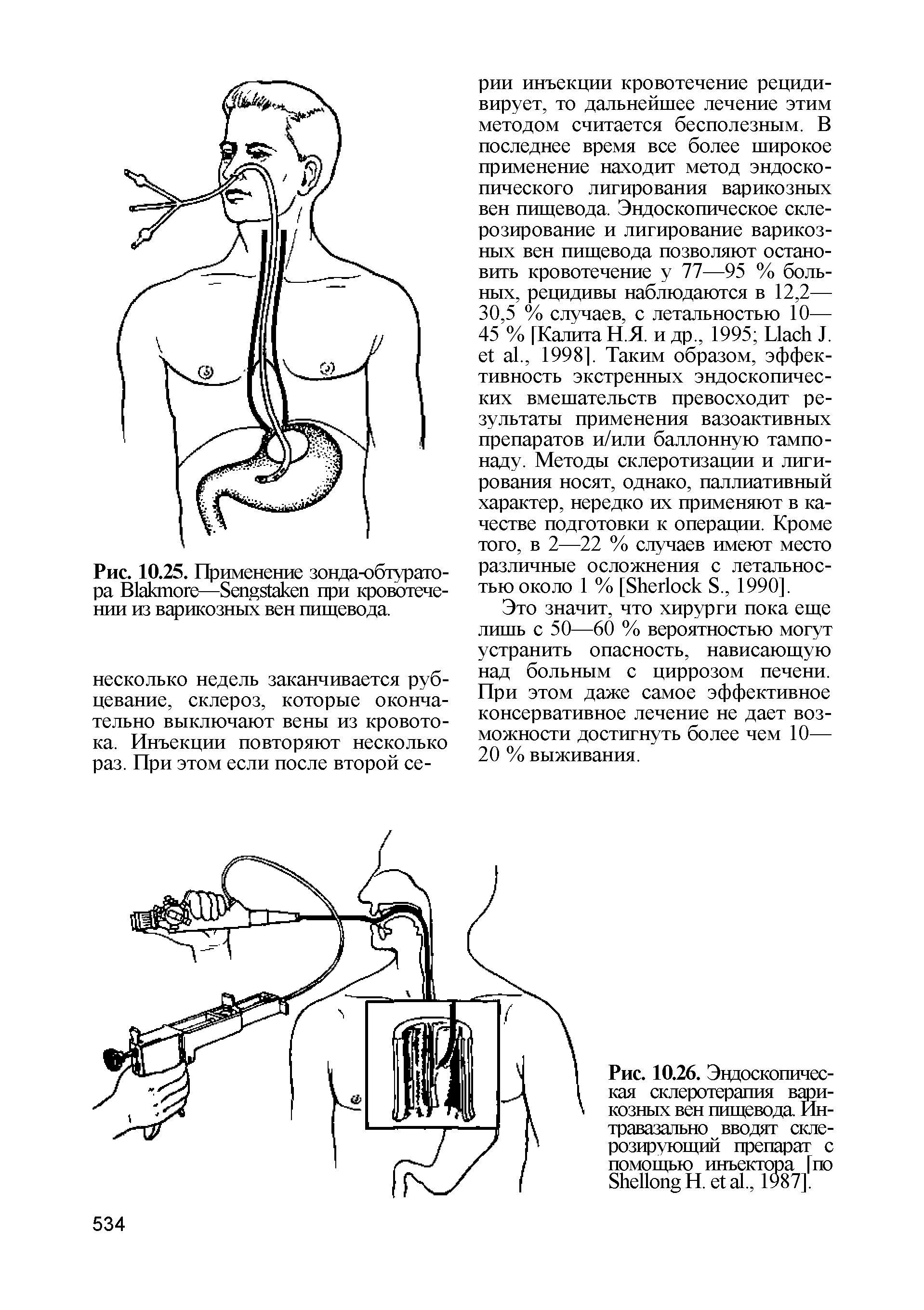 Какой врач лечит пищевод