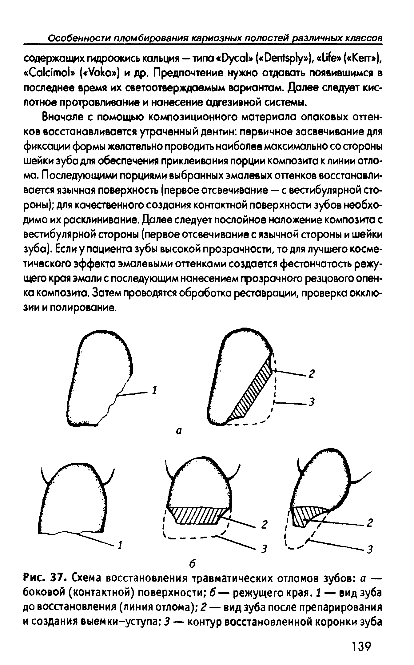 Рис. 37. Схема восстановления травматических отломов зубов а — боковой (контактной) поверхности б — режущего края. 1 — вид зуба до восстановления (линия отлома) 2 — вид зуба после препарирования и создания выемки-уступа 3 — контур восстановленной коронки зуба...