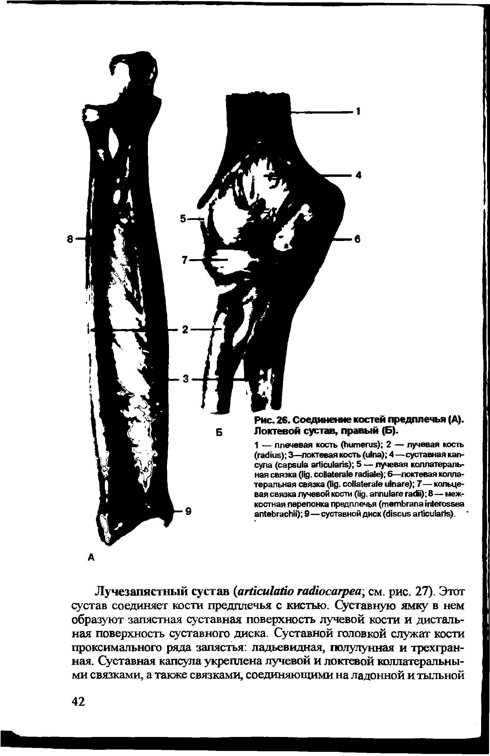 Рис. 26. Соединение костей предплечья (А). Локтевой сустав, правый (Б).