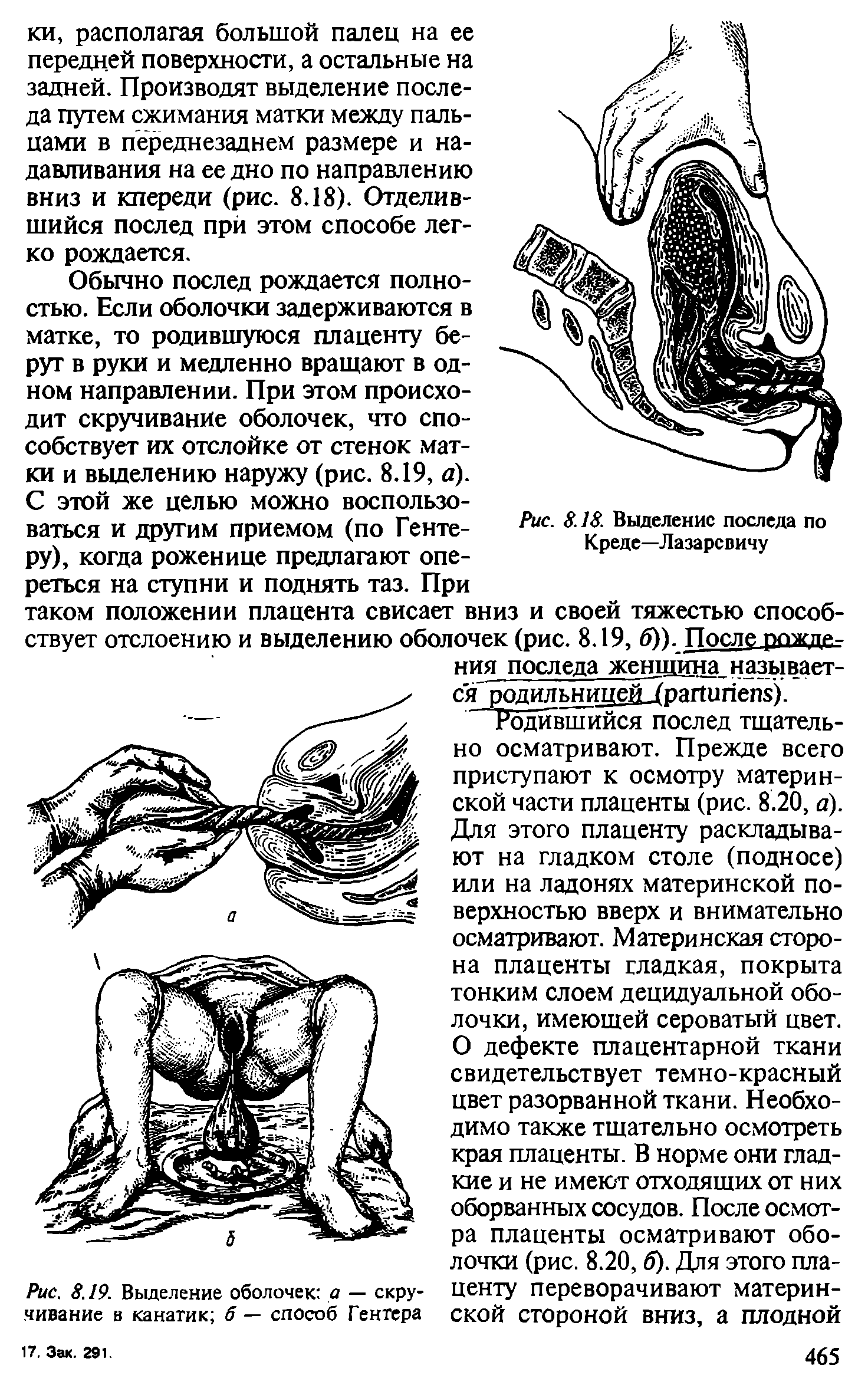 Рис. 8.19. Выделение оболочек а — скручивание в канатик б — способ Гентера...