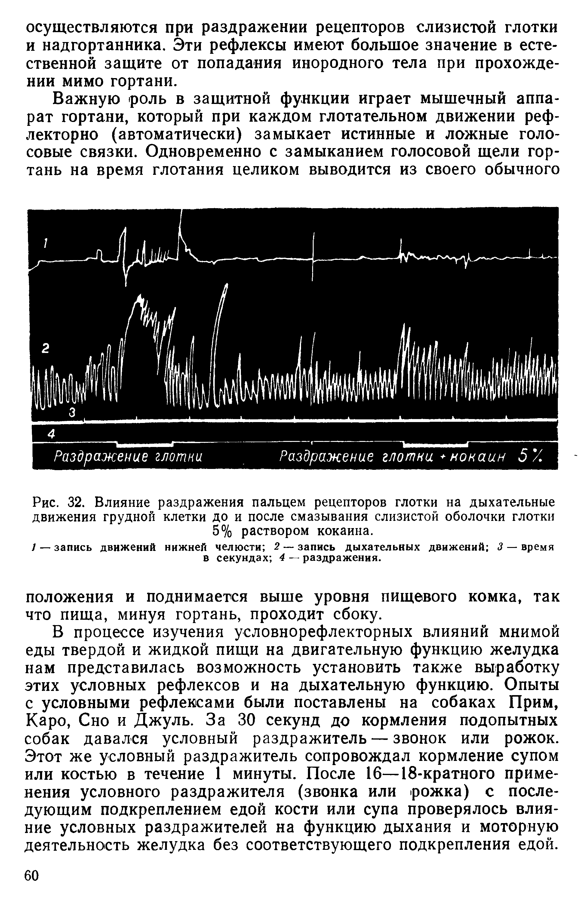 Рис. 32. Влияние раздражения пальцем рецепторов глотки на дыхательные движения грудной клетки до и после смазывания слизистой оболочки глотки 5% раствором кокаина.