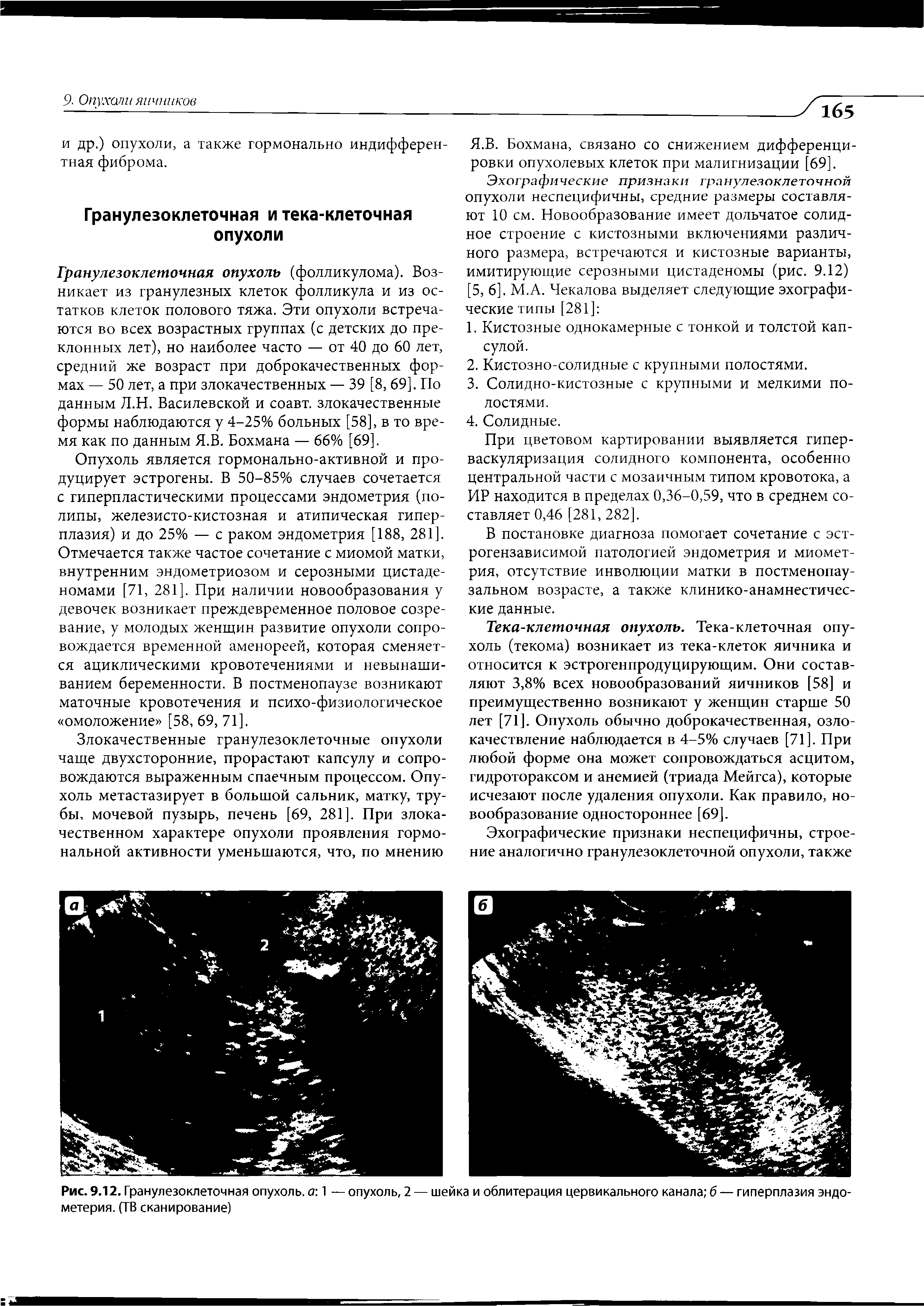 Рис. 9.12. Гранулезоклеточная опухоль, а 1 — опухоль, 2 — шейка и облитерация цервикального канала б — гиперплазия эндо-метерия. (ТВ сканирование)...