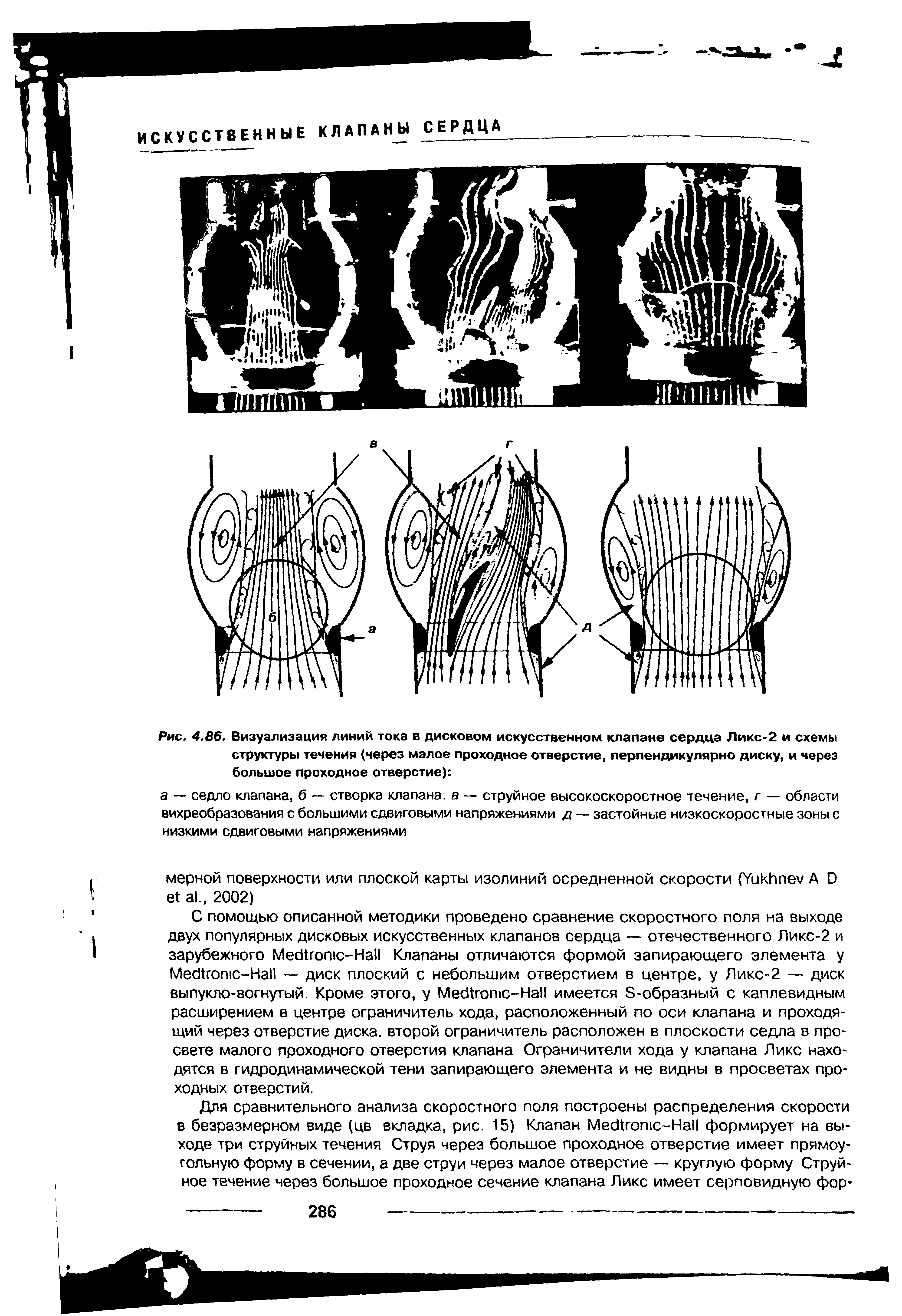 Рис. 4.86. Визуализация линий тока в дисковом искусственном клапане сердца Л икс-2 и схемы структуры течения (через малое проходное отверстие, перпендикулярно диску, и через большое проходное отверстие) ...