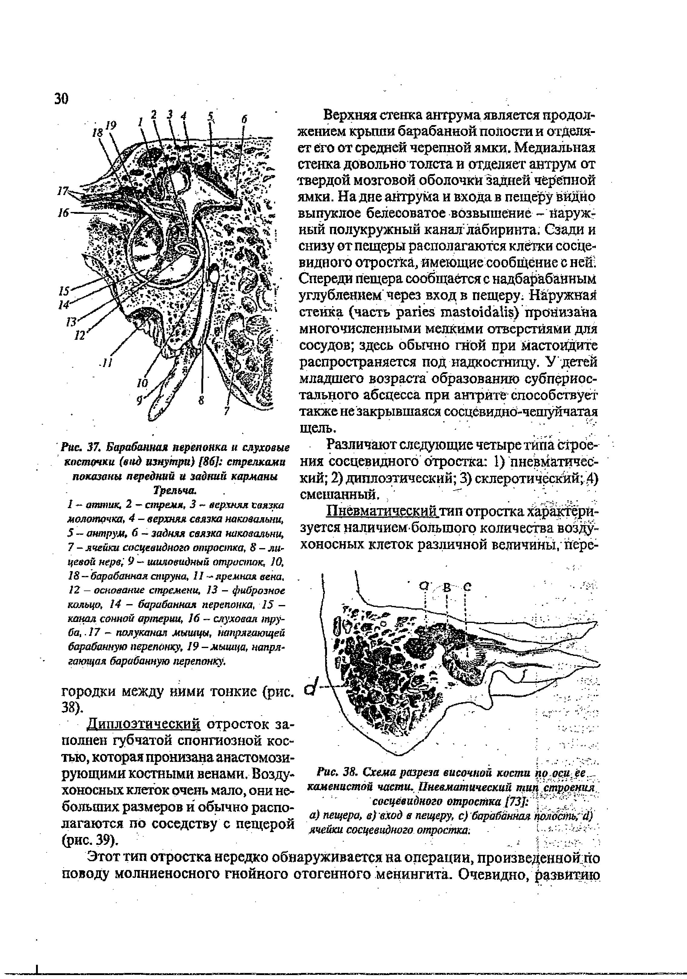 Рис. 37. Барабанная перепонка и слуховые косточки (вид изнутри) [86] стрелками показаны передний и задний карманы Трельча.