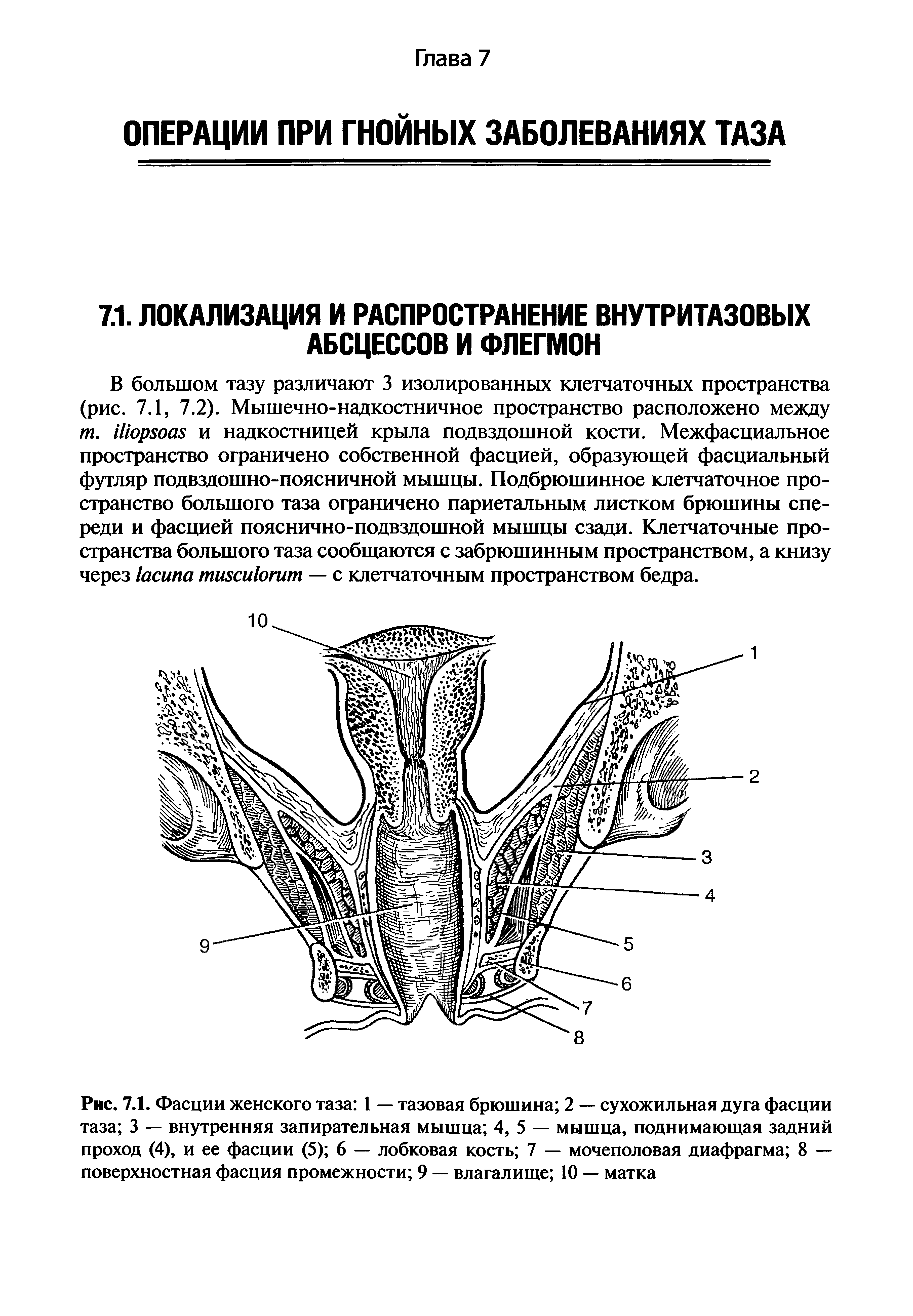 Рис. 7.1. Фасции женского таза 1 — тазовая брюшина 2 — сухожильная дуга фасции таза 3 — внутренняя запирательная мышца 4, 5 — мышца, поднимающая задний проход (4), и ее фасции (5) 6 — лобковая кость 7 — мочеполовая диафрагма 8 — поверхностная фасция промежности 9 — влагалище 10 — матка...