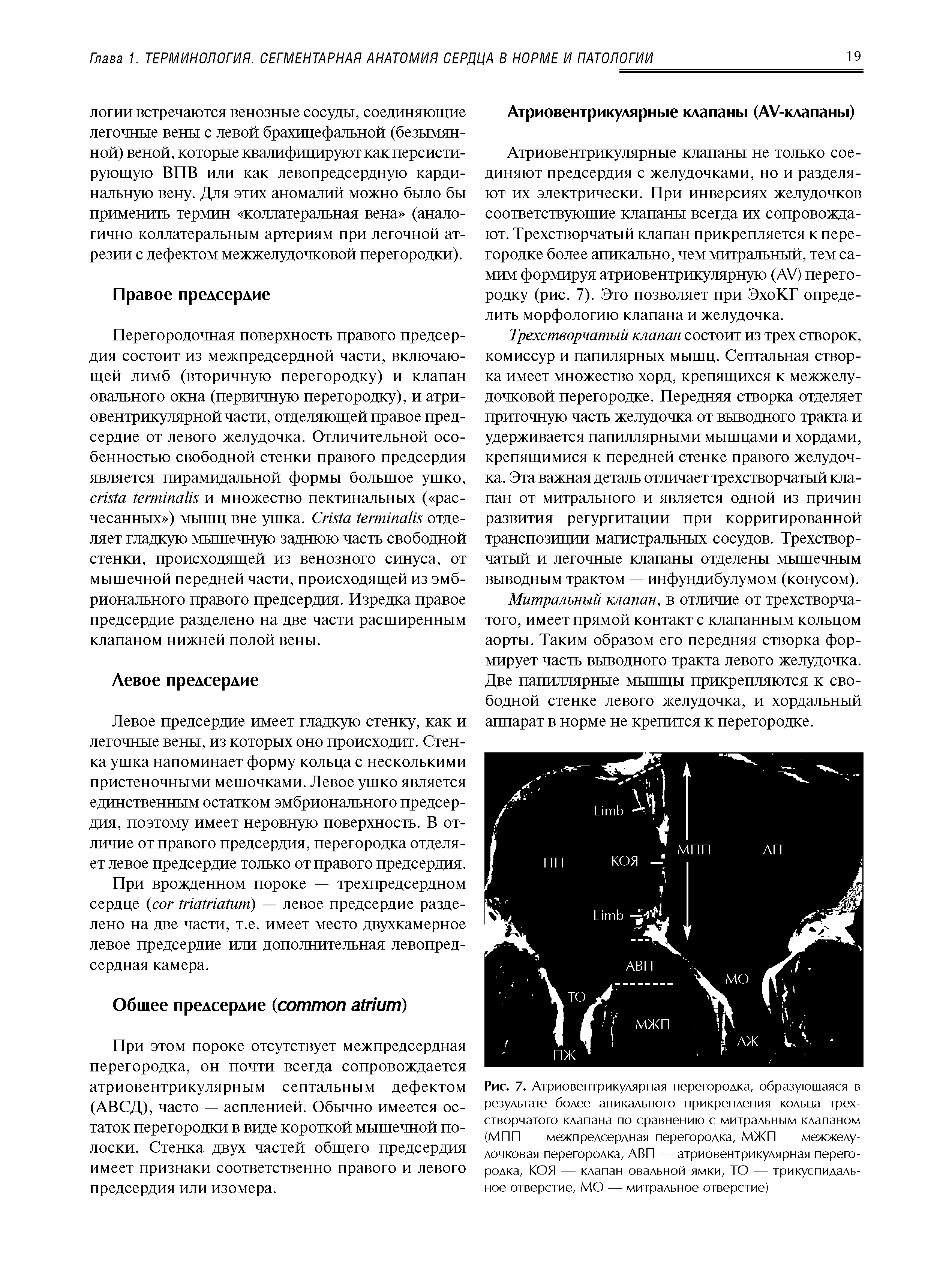 Рис. 7. Атриовентрикулярная перегородка, образующаяся в результате более апикального прикрепления кольна трехстворчатого клапана по сравнению с митральным клапаном (МПП — межпредсердная перегородка, МЖП — межжелудочковая перегородка, АВП — атриовентрикулярная перегородка, КОЯ — клапан овальной ямки, ТО — трикуспидальное отверстие, МО — митральное отверстие)...