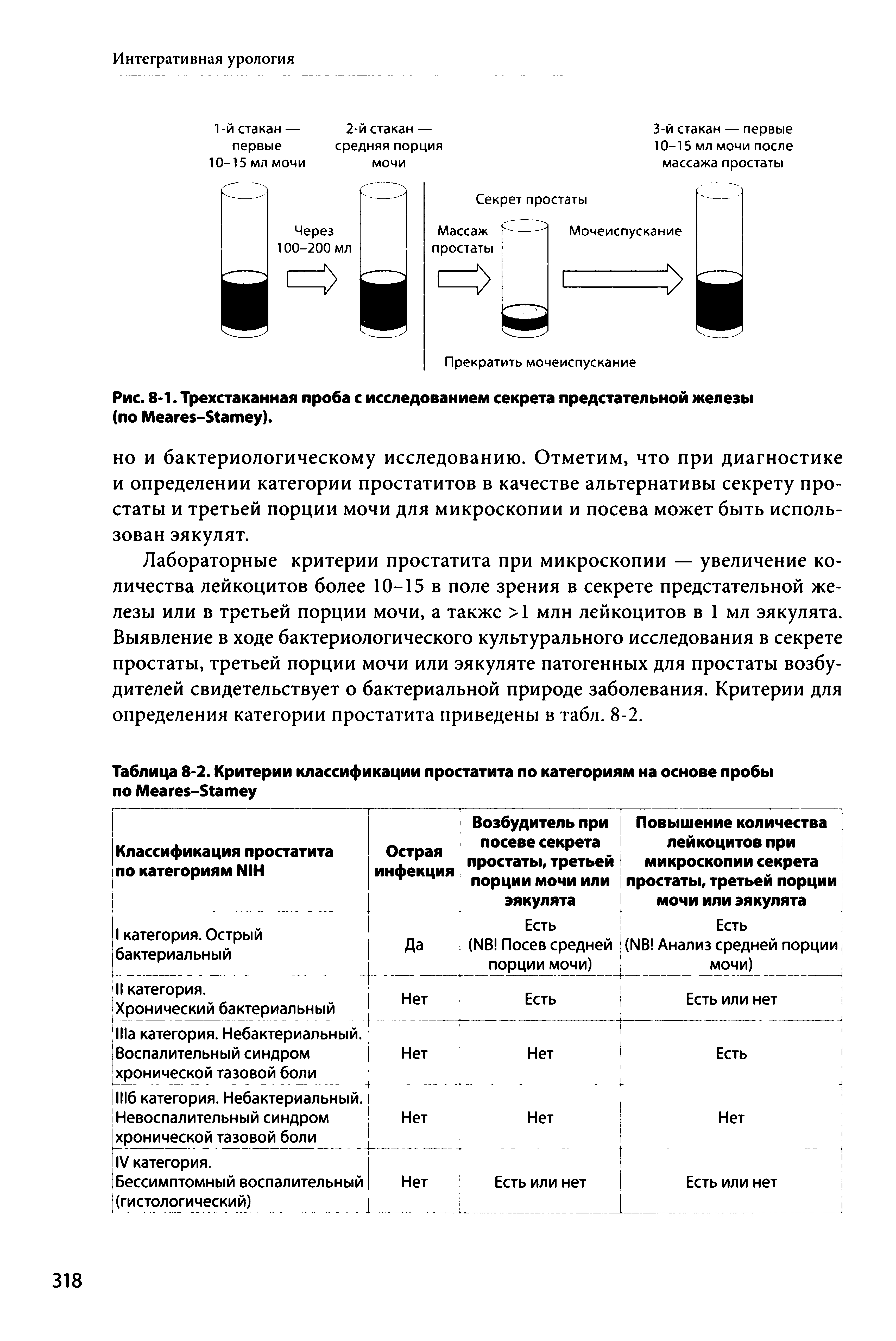 Рис. 8-1. Трехстаканная проба с исследованием секрета предстательной железы (по M -S ).