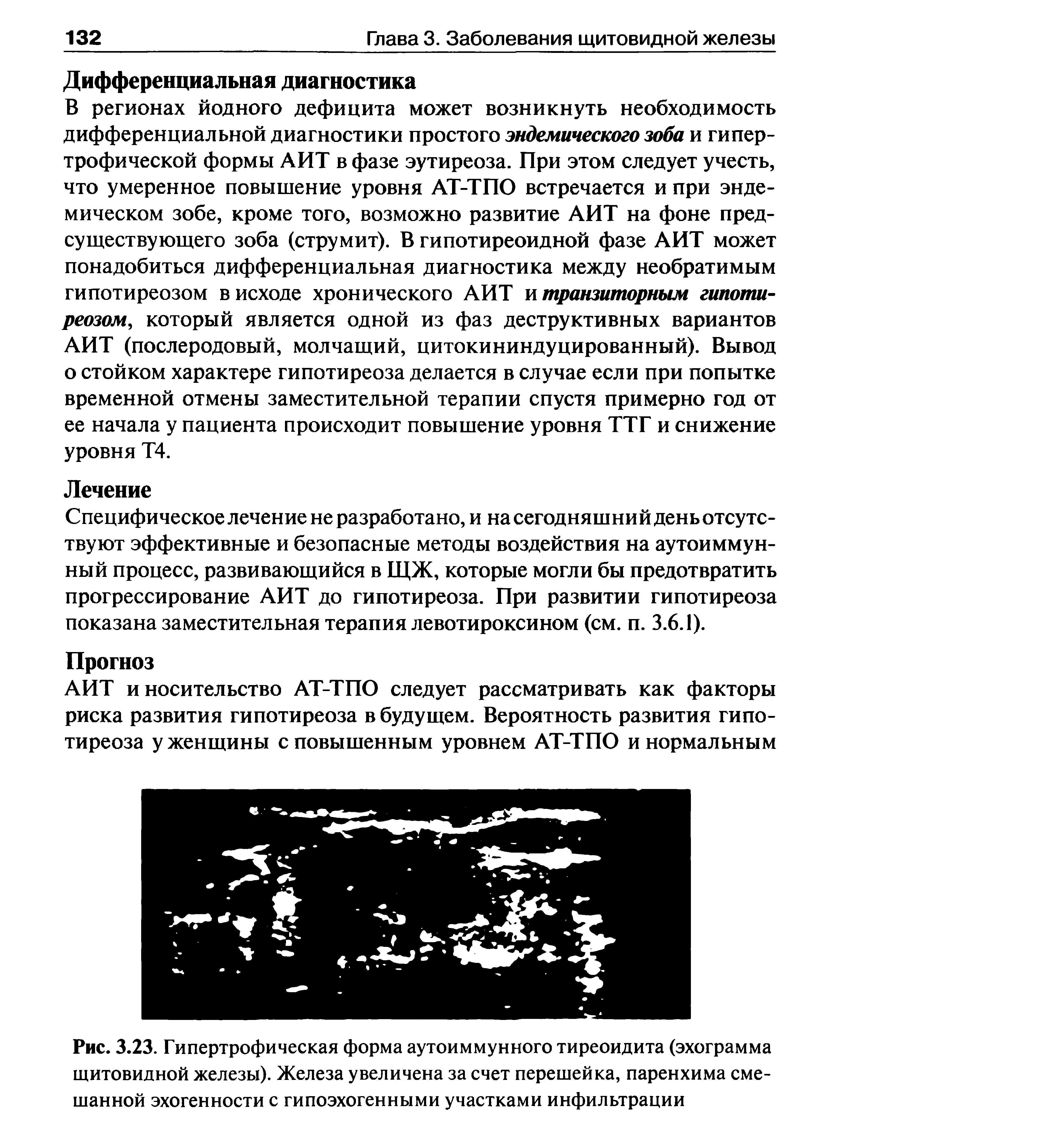 Рис. 3.23. Гипертрофическая форма аутоиммунного тиреоидита (эхограмма щитовидной железы). Железа увеличена за счет перешейка, паренхима смешанной эхогенности с гипоэхогенными участками инфильтрации...