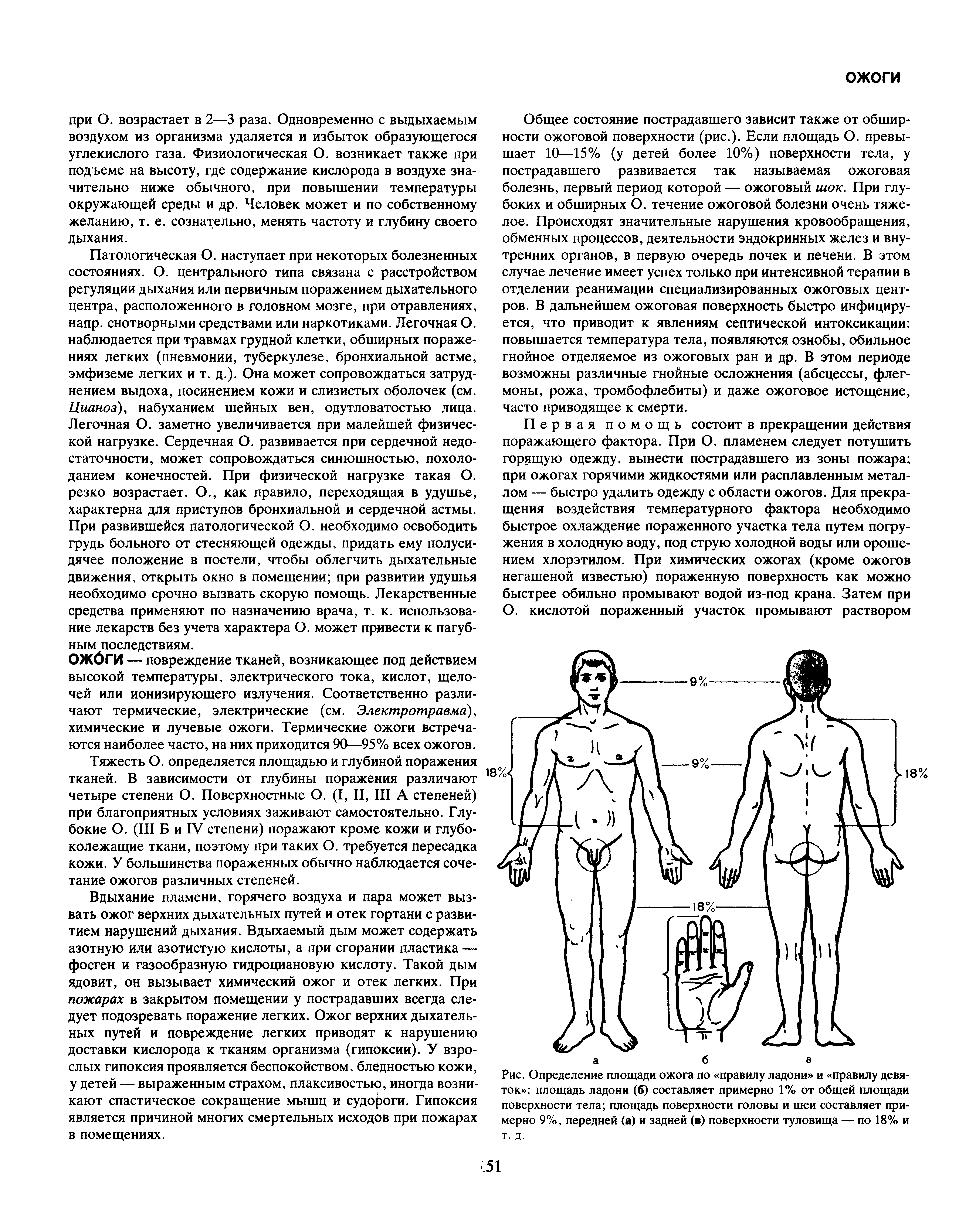 Рис. Определение площади ожога по правилу ладони и правилу девяток площадь ладони (б) составляет примерно 1% от общей площади поверхности тела площадь поверхности головы и шеи составляет примерно 9%, передней (а) и задней (в) поверхности туловища — по 18% и т. д.