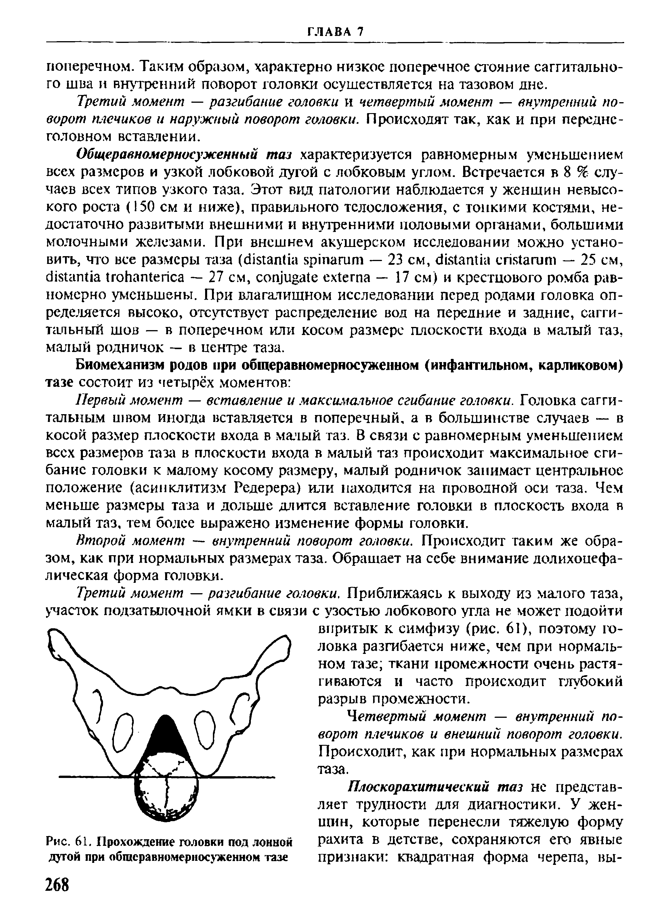 Рис. 61. Прохождение головки под лонной дугой при общеравномерносуженном тазе...