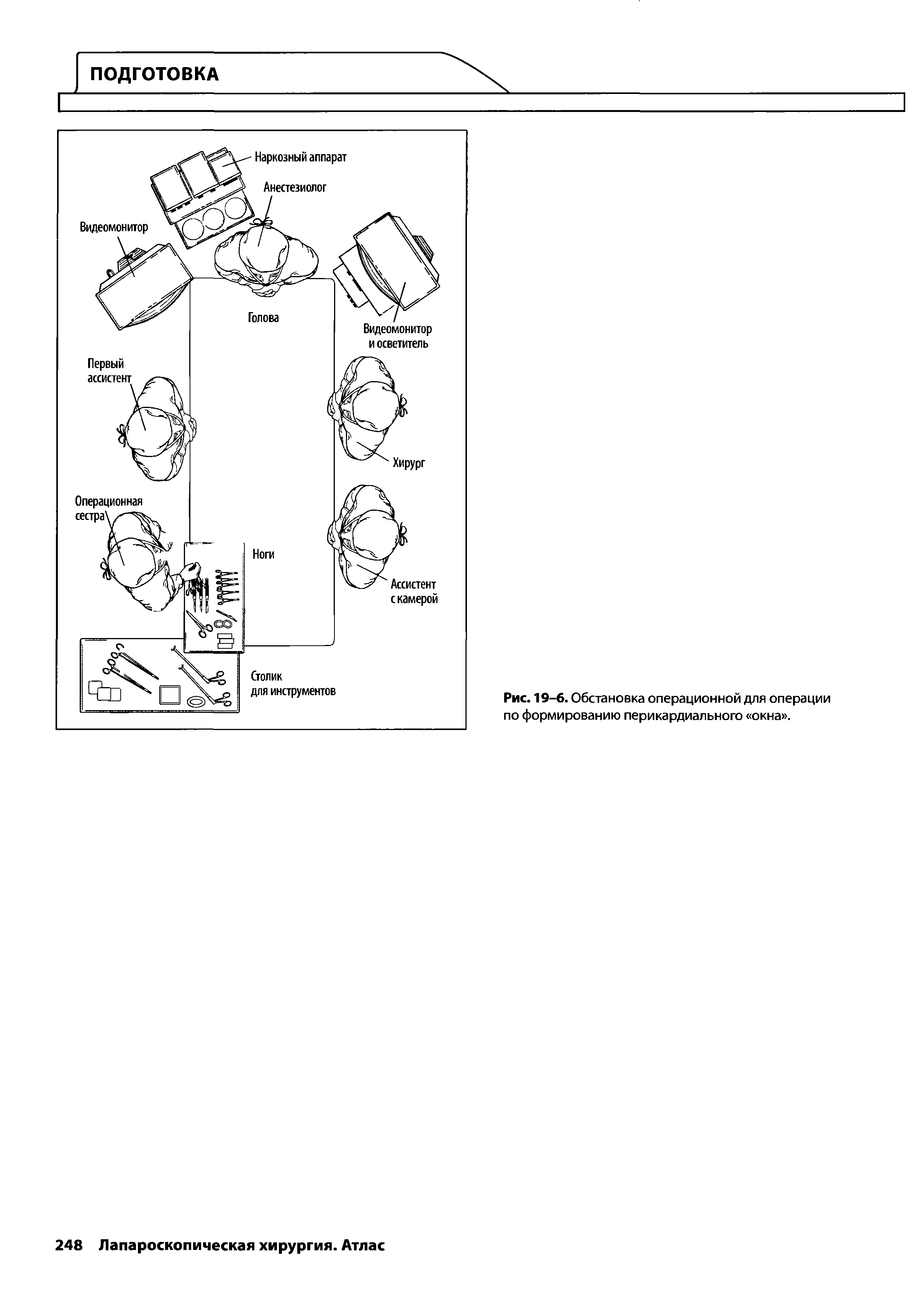 Рис. 19-6. Обстановка операционной для операции по формированию перикардиального окна .