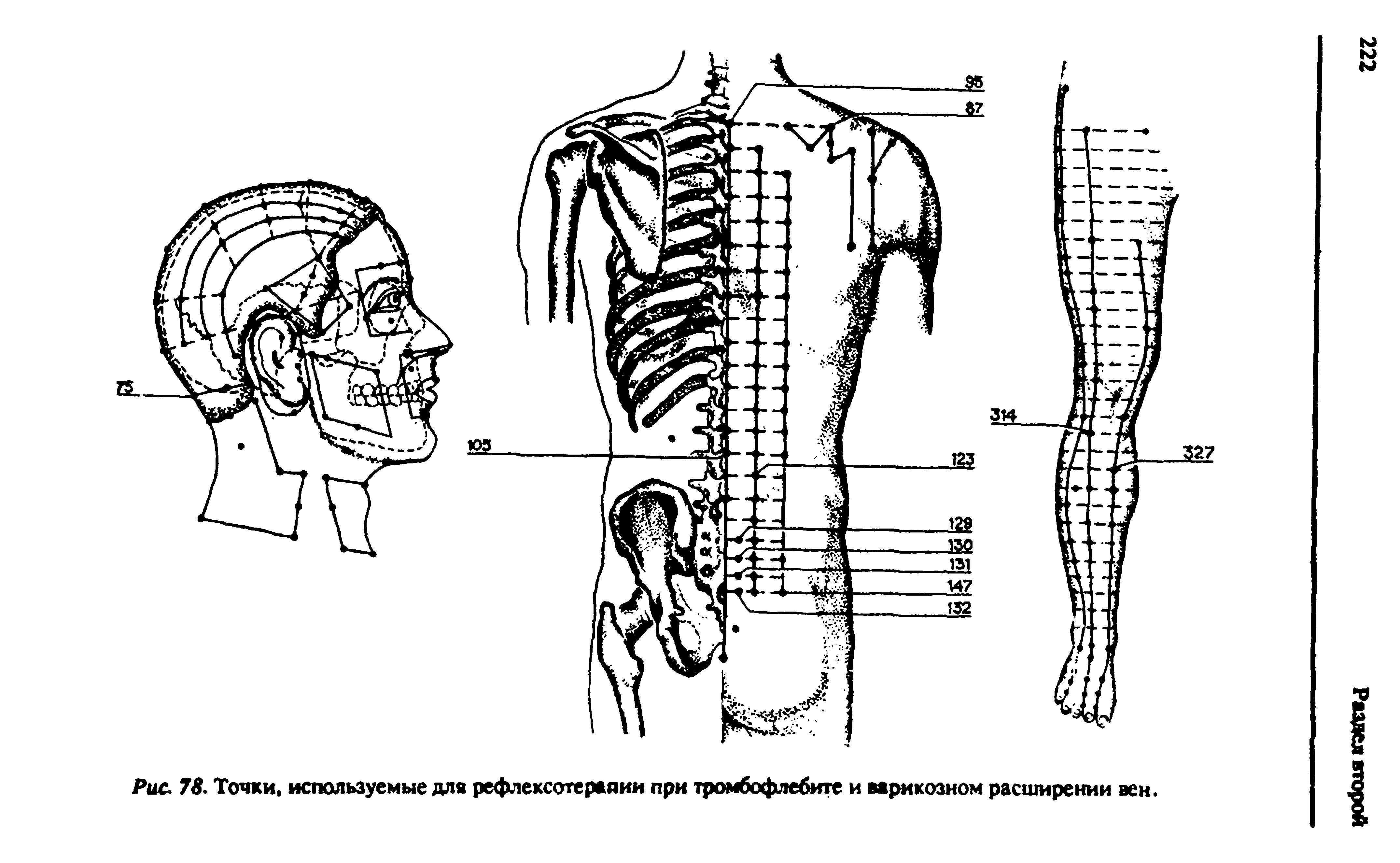 Рис. 78. Точки, используемые для рефлексотерапии при тромбофлебите и варикозном расширении вен.