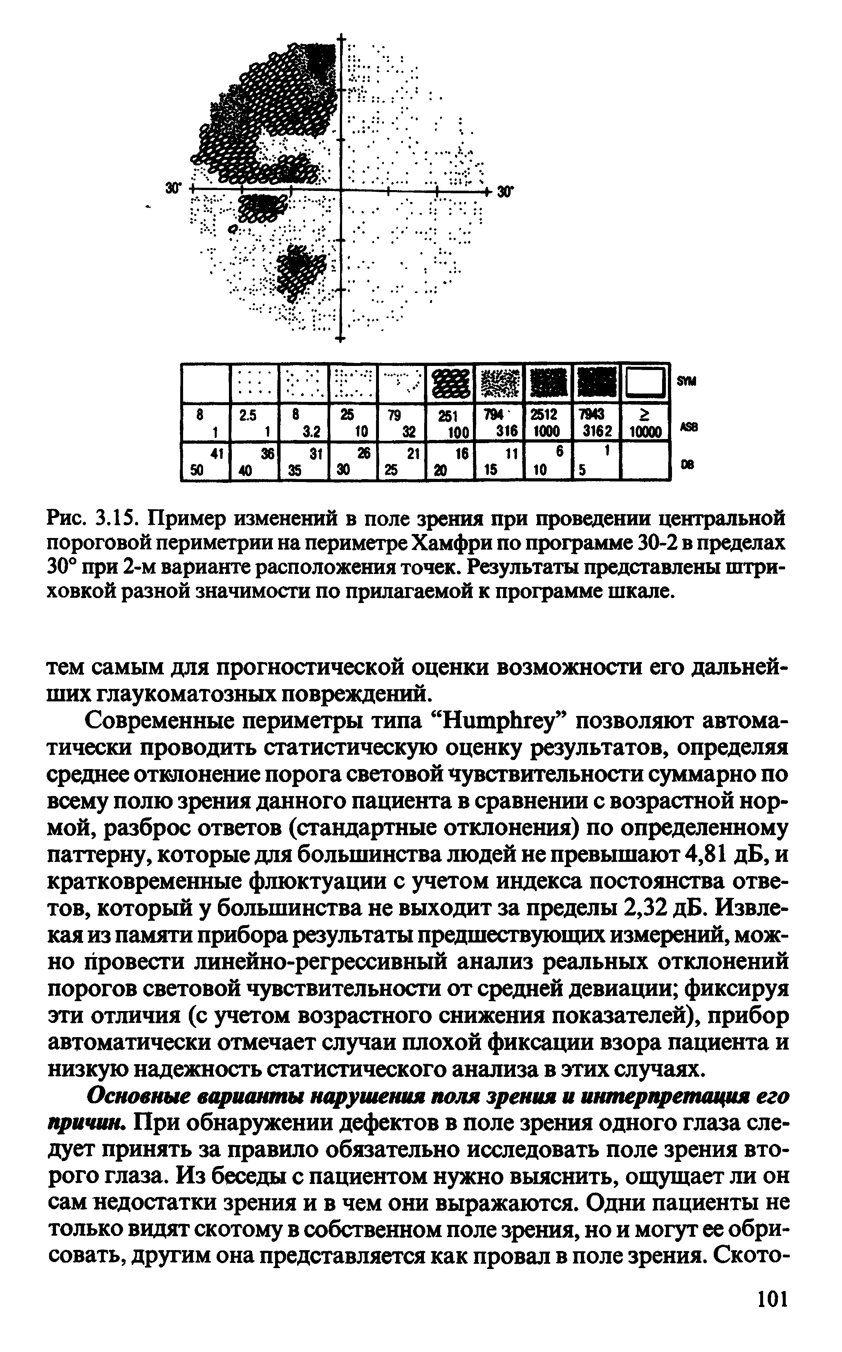 Рис. 3.15. Пример изменений в поле зрения при проведении центральной пороговой периметрии на периметре Хамфри по программе 30-2 в пределах 30° при 2-м варианте расположения точек. Результаты представлены штриховкой разной значимости по прилагаемой к программе шкале.