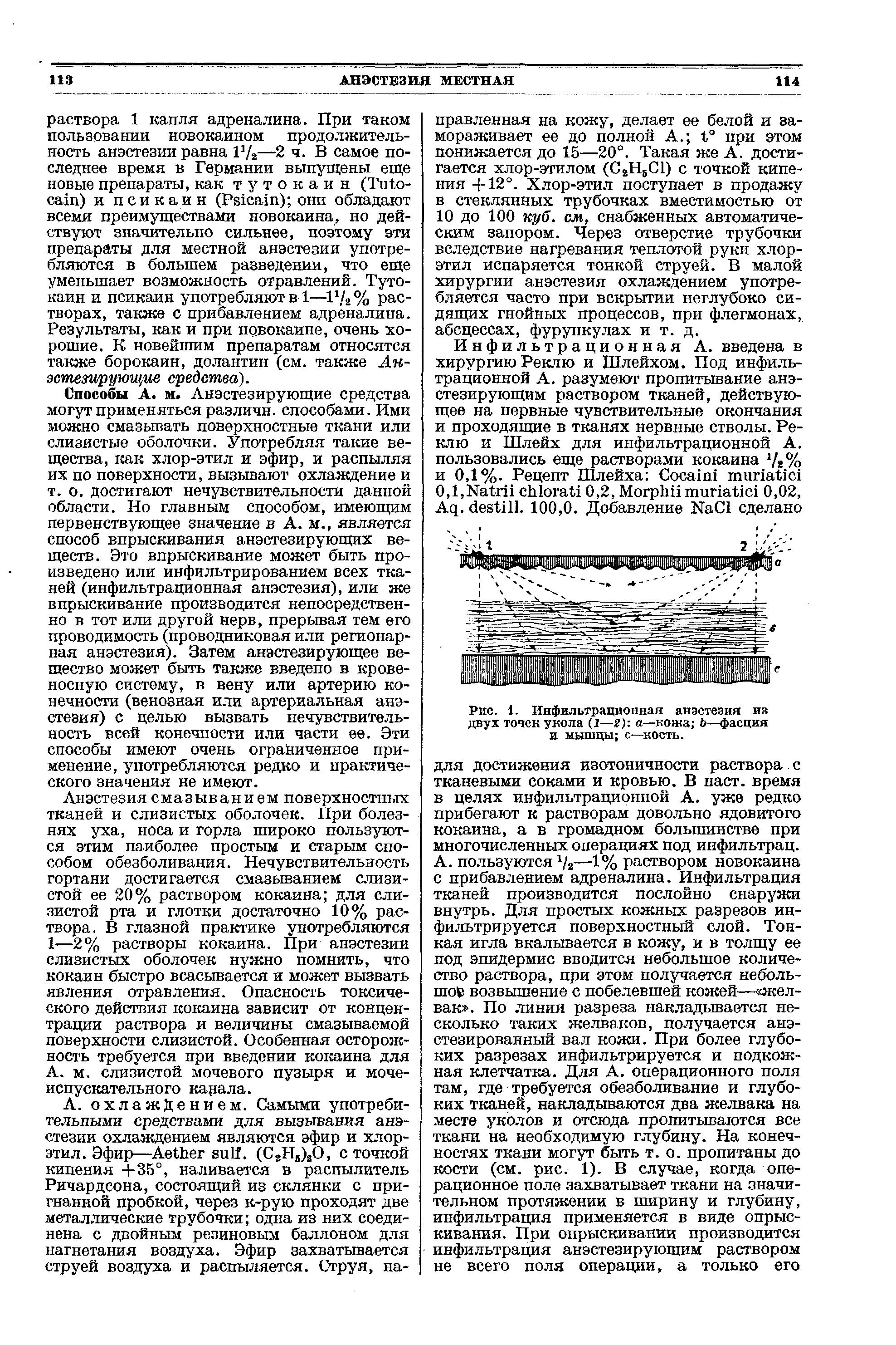 Рис. 1. Инфильтрационная анэстезия из двух точек укола (1—2) а—кожа Ь—фасция и мышцы с—кость.