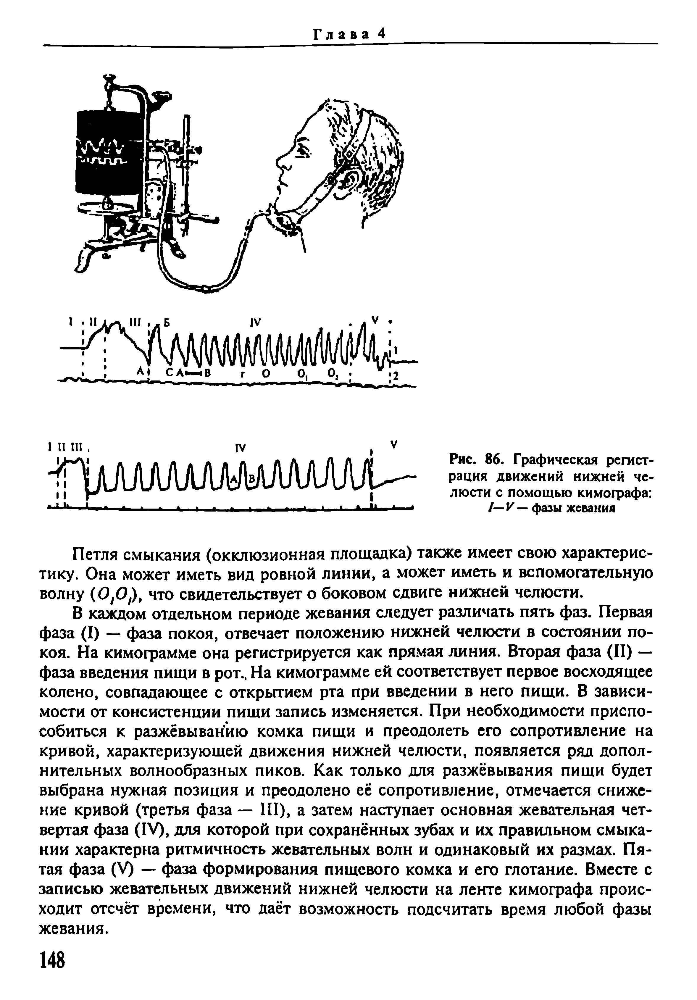 Рис. 86. Графическая регистрация движений нижней челюсти с помощью кимографа —V— фазы жевания...