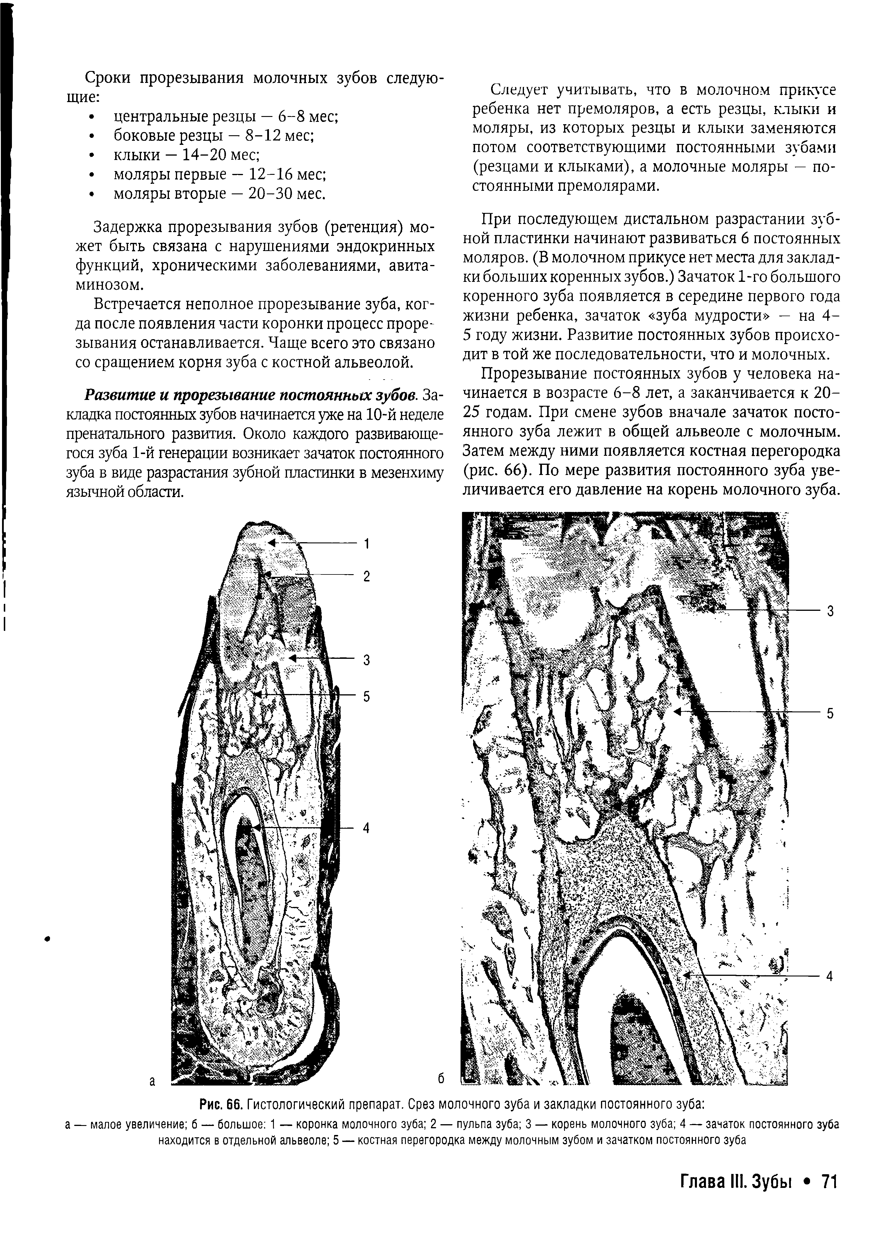 Рис. 66. Гистологический препарат. Срез молочного зуба и закладки постоянного зуба ...