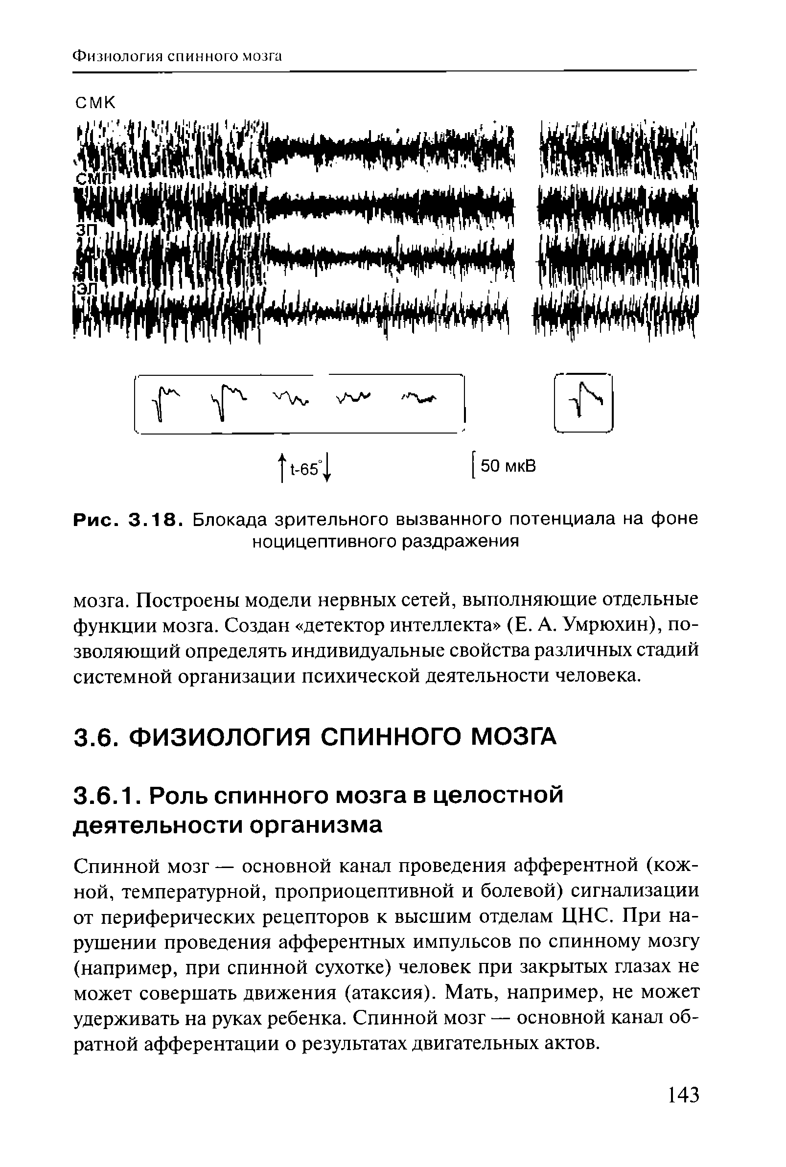 Рис. 3.18. Блокада зрительного вызванного потенциала на фоне ноцицептивного раздражения...