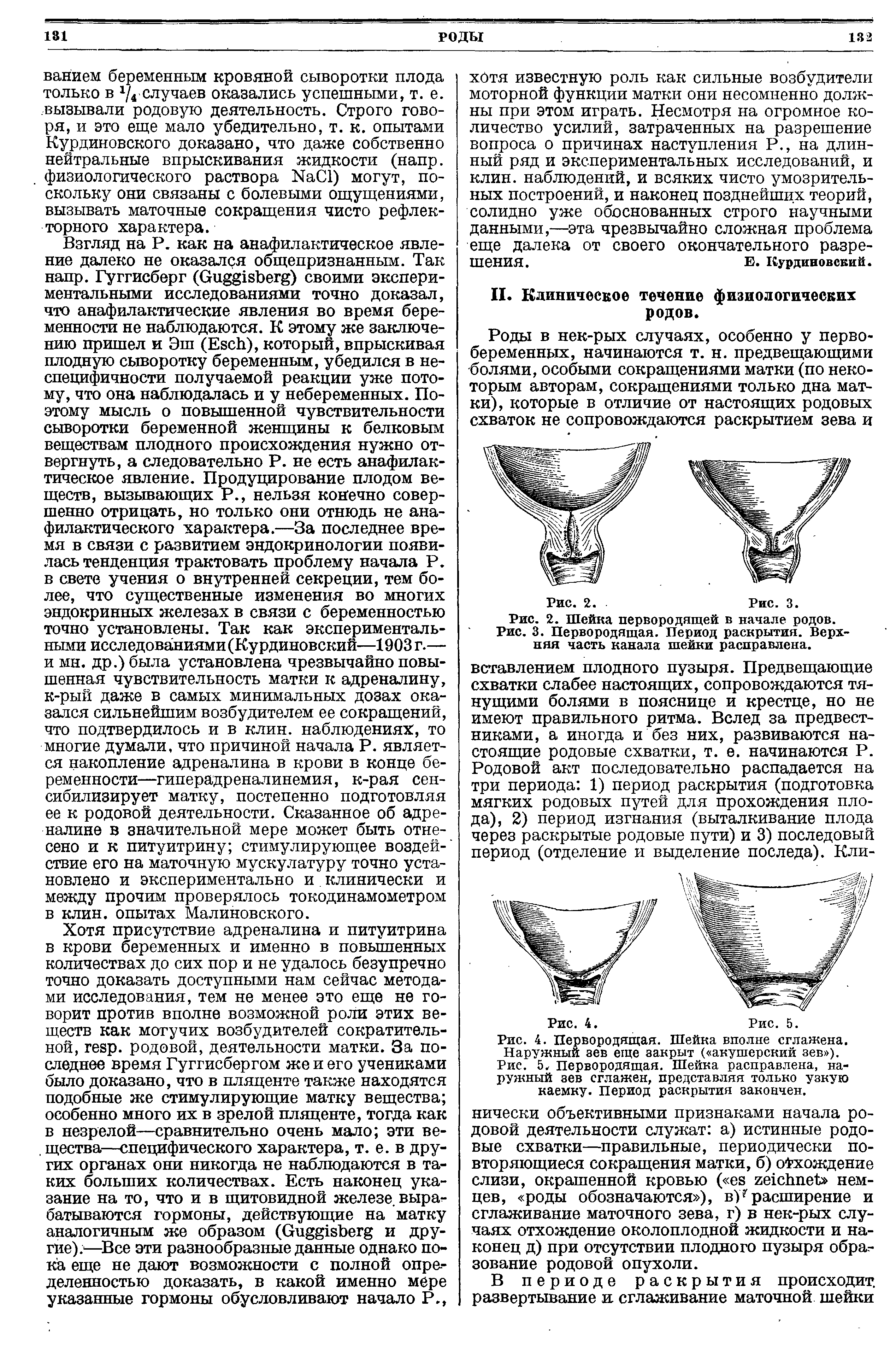 Рис. 4. Первородящая. Шейка вполне сглажена. Наружный зев еще закрыт ( акушерский зев ).