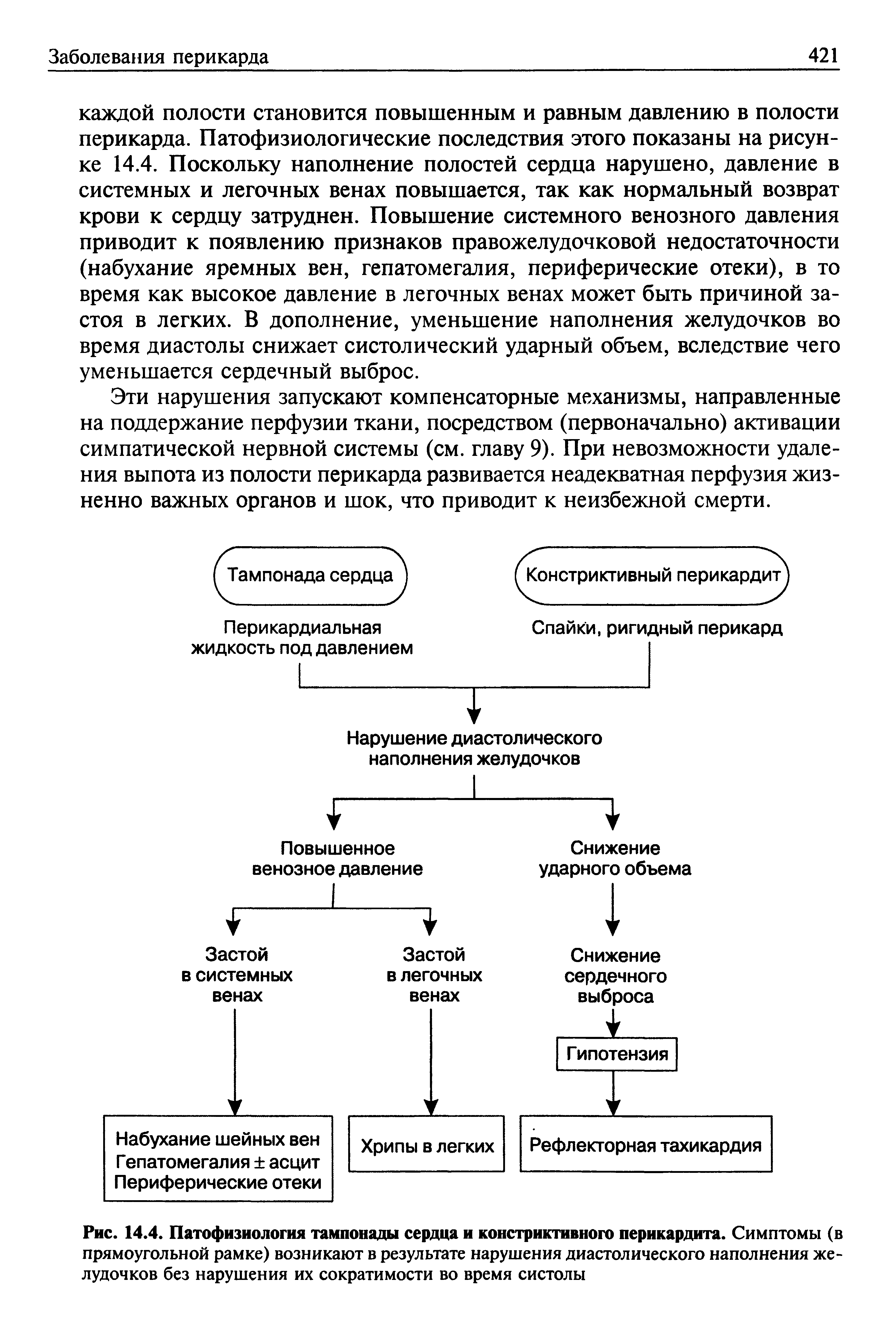 Рис. 14.4. Патофизиология тампонады сердца и констриктивного перикардита. Симптомы (в прямоугольной рамке) возникают в результате нарушения диастолического наполнения желудочков без нарушения их сократимости во время систолы...