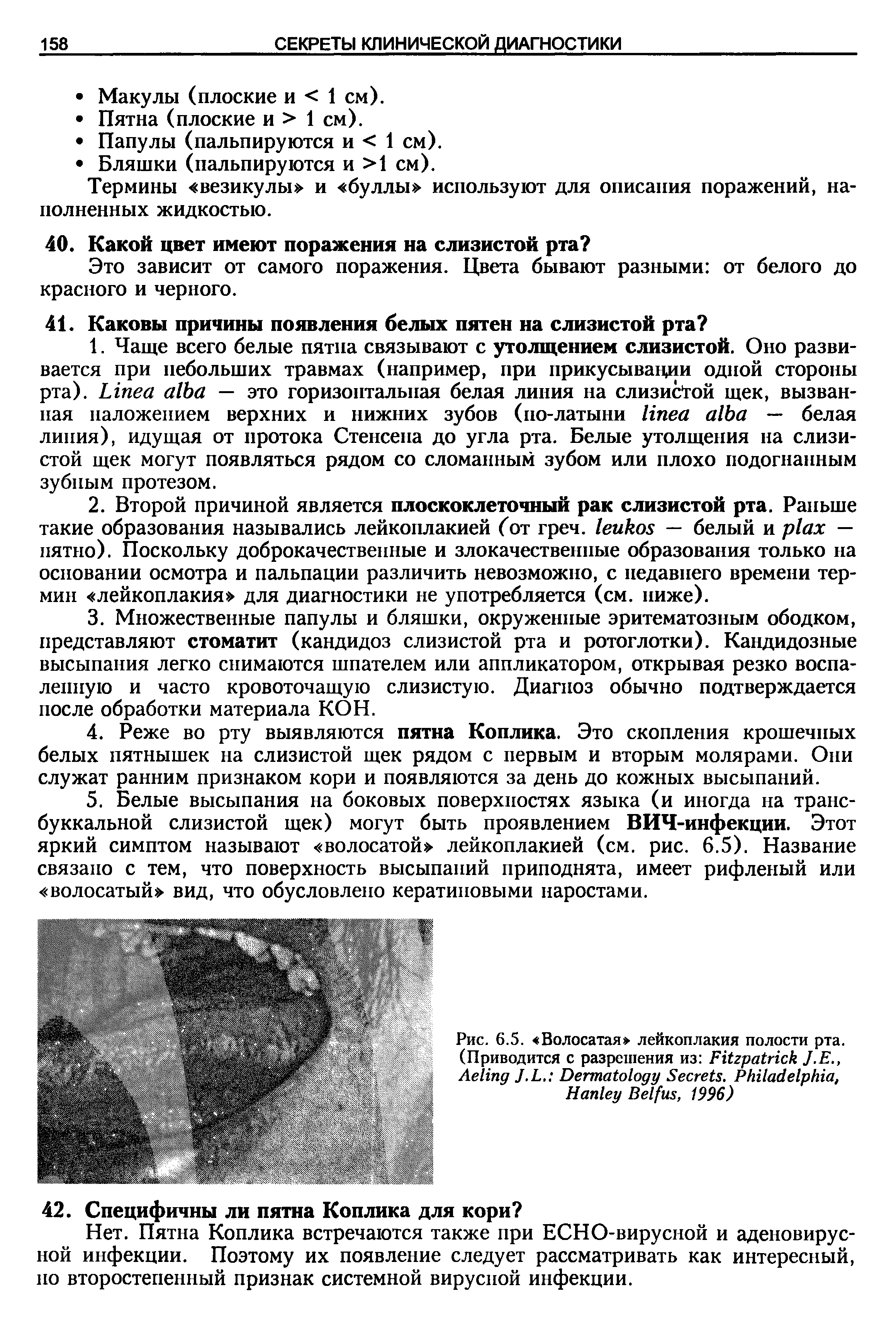 Рис. 6.5. Волосатая лейкоплакия полости рта. (Приводится с разрешения из F J.E., A J.L. D S . P , H B , 1996)...