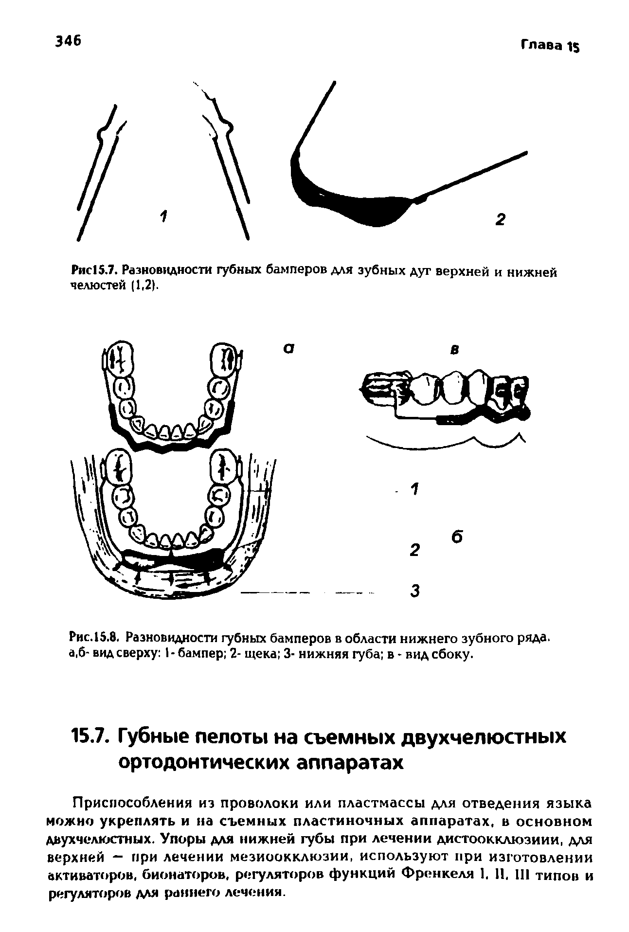 Рис.15.8. Разновидности губных бамперов в области нижнего зубного ряда. а,б- вид сверху 1 - бампер 2- щека 3- нижняя губа в - вид сбоку.