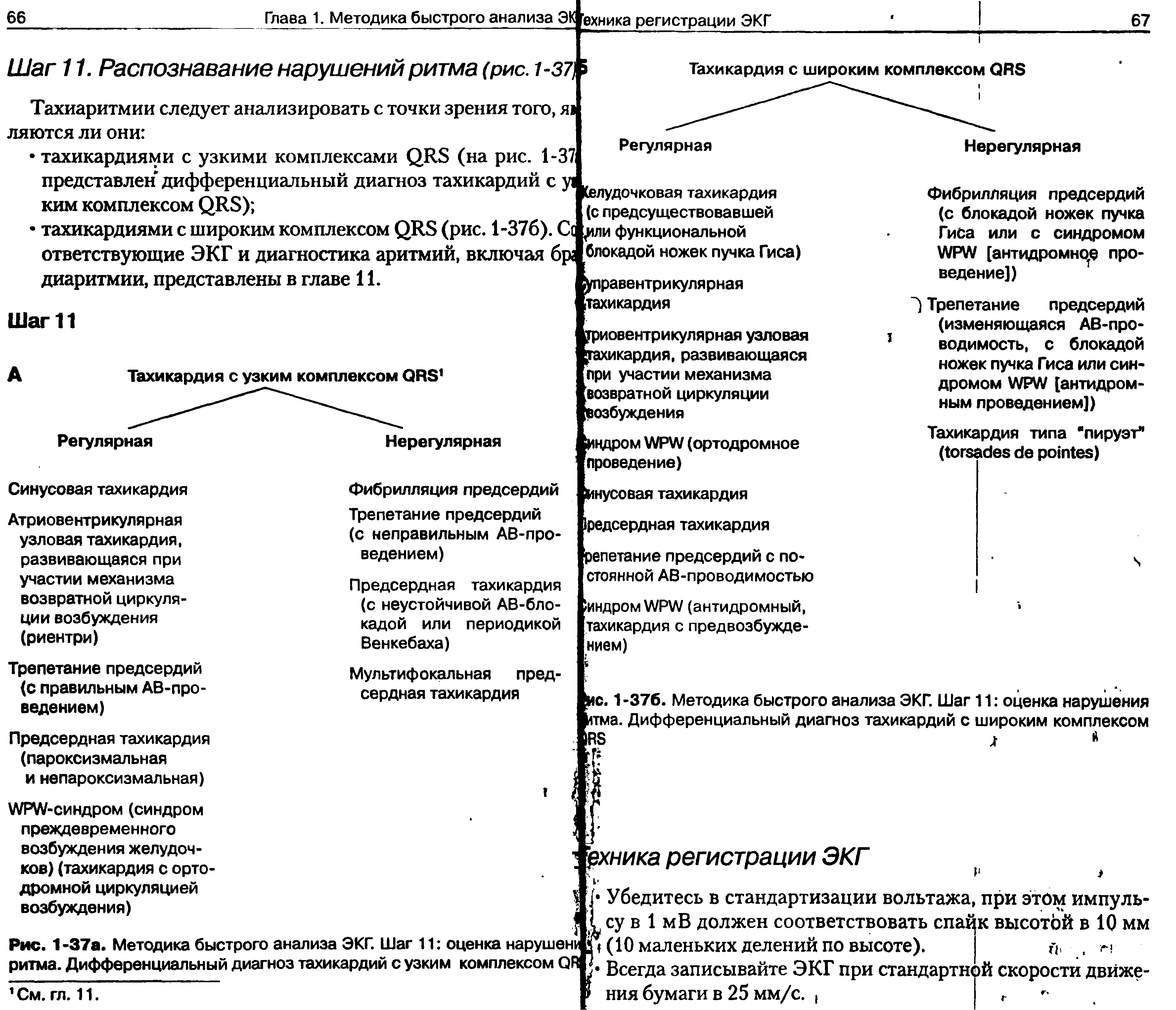 Рис. 1 -37а. Методика быстрого анализа ЭКГ. Шаг 11 оценка нарушена ритма. Дифференциальный диагноз тахикардий с узким комплексом ОЯ. ссеГда записывайте а...