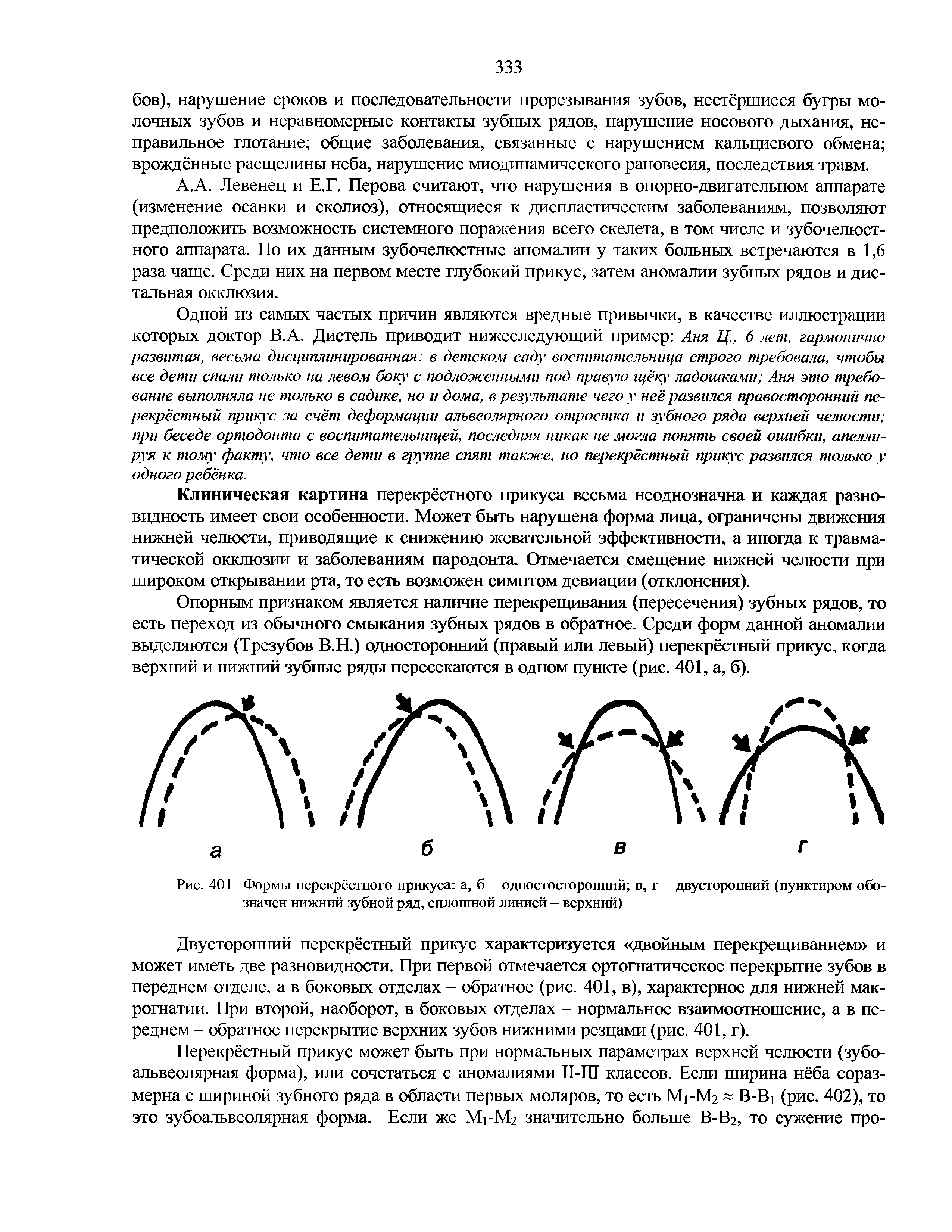 Рис. 401 Формы перекрёстного прикуса а, б одностосторонний в, г двусторонний (пунктиром обозначен нижний зубной ряд, сплошной линией — верхний)...