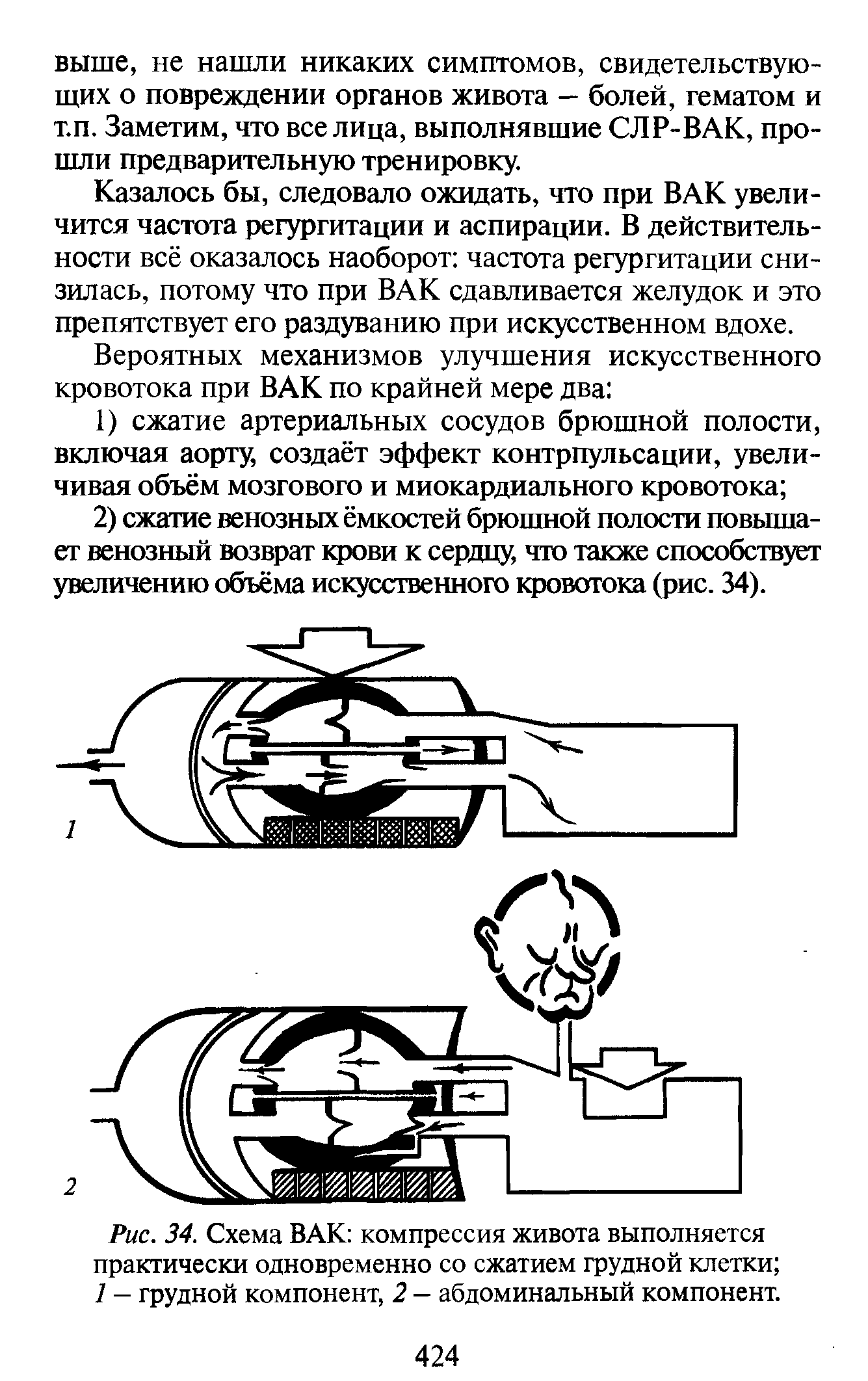 Рис. 34. Схема ВАК компрессия живота выполняется практически одновременно со сжатием грудной клетки 1 — грудной компонент, 2 — абдоминальный компонент.